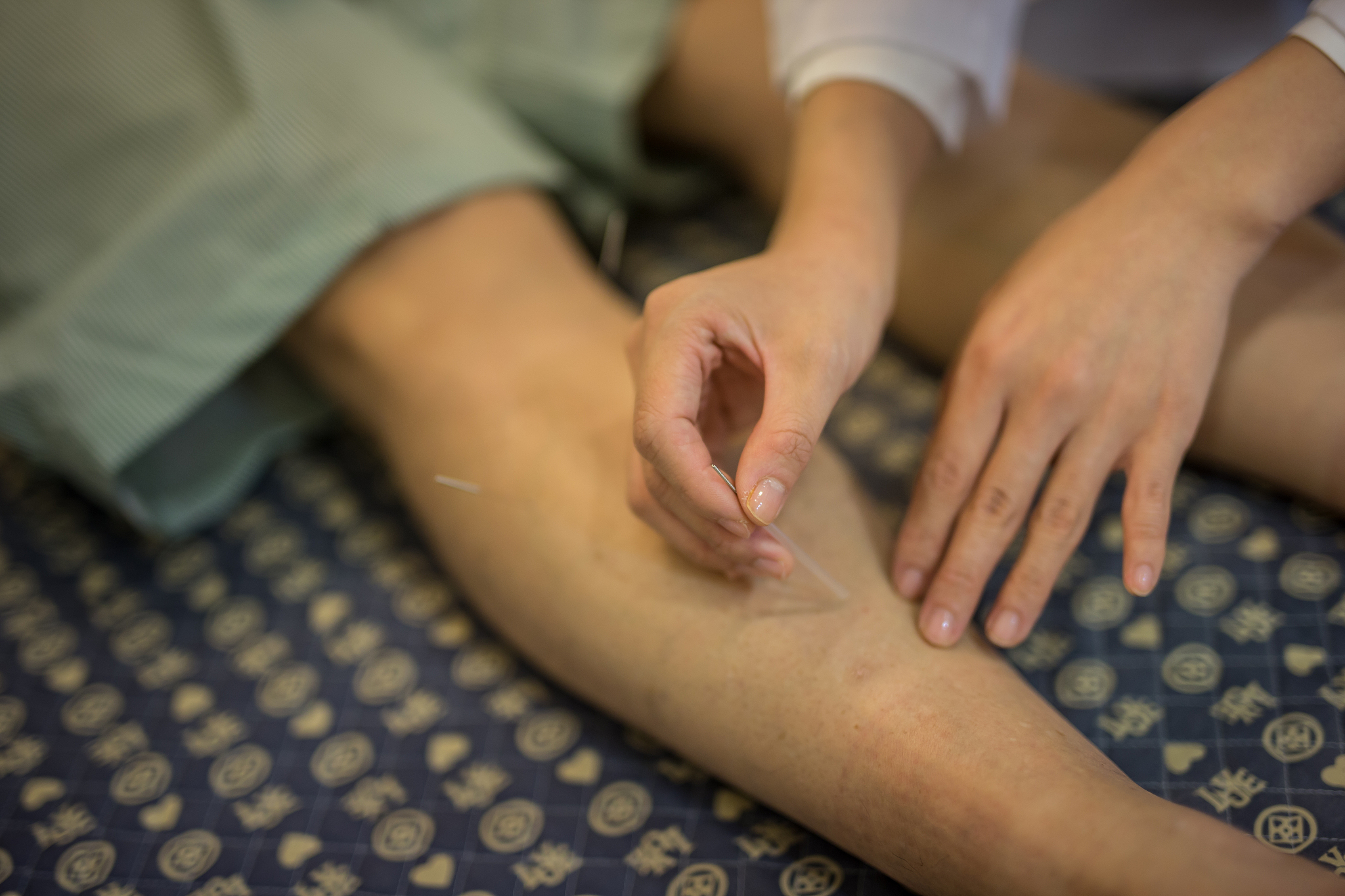 瘢痕疙瘩疼痛怎么办