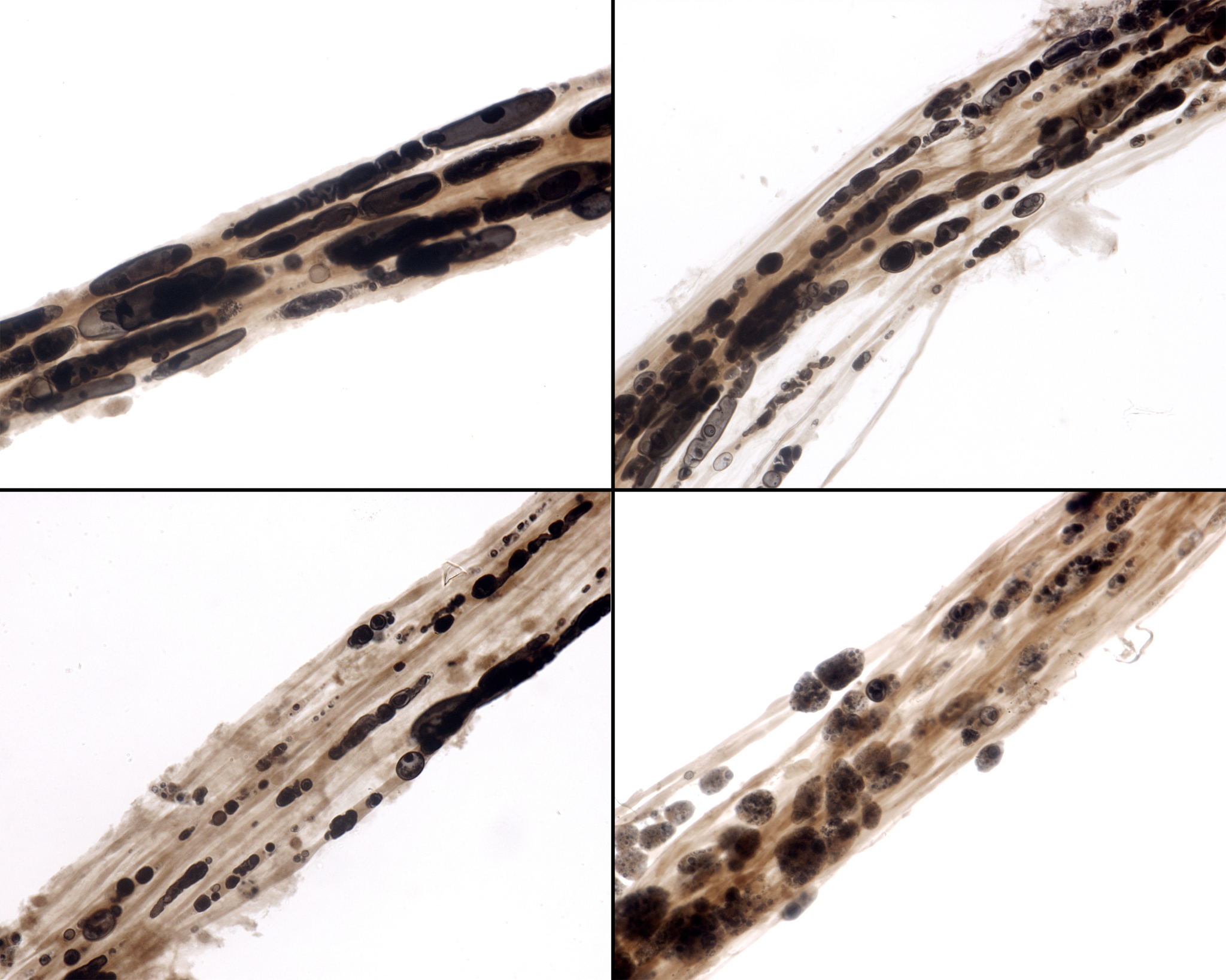 神经元传递速度：快慢差异与影响