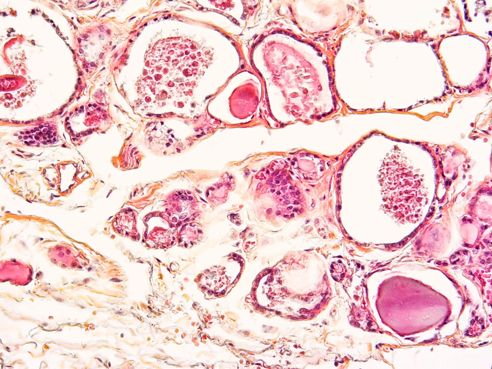 将系列语句翻译成英文使其表达更地道逻辑性更强：切片滴加05的甲酚紫溶液室温下染色10min