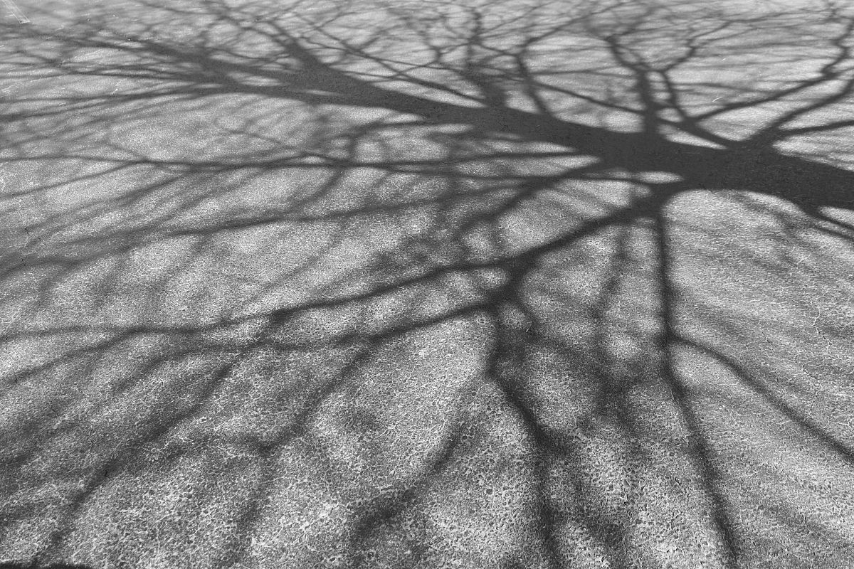 肝门静脉收集哪些脏器的静脉血？属支有哪些？