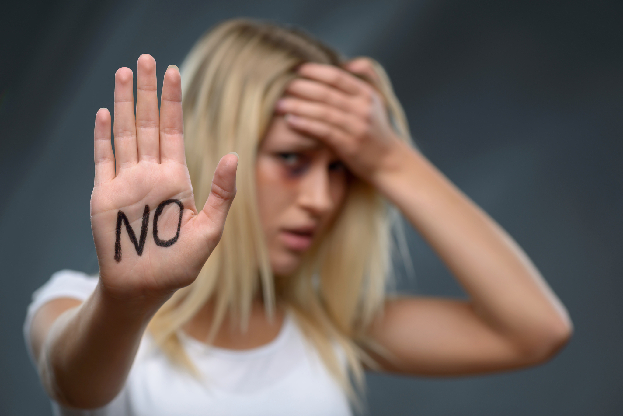 フランス革命のメリットとデメリット: 歴史的影響と考察