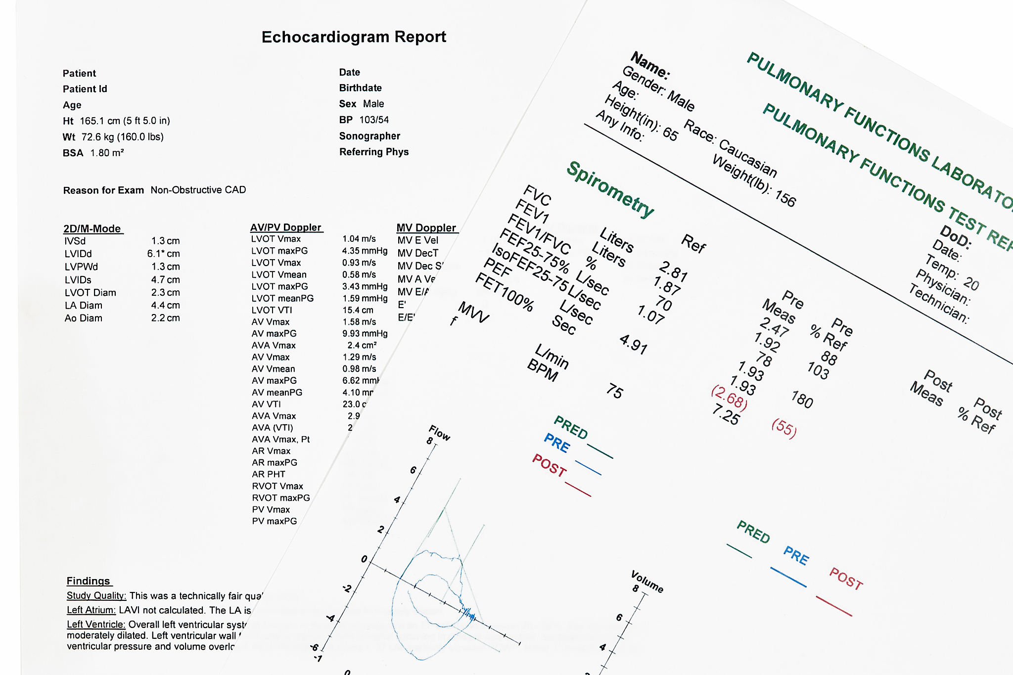 close up of pulmonary functions test and ecg report