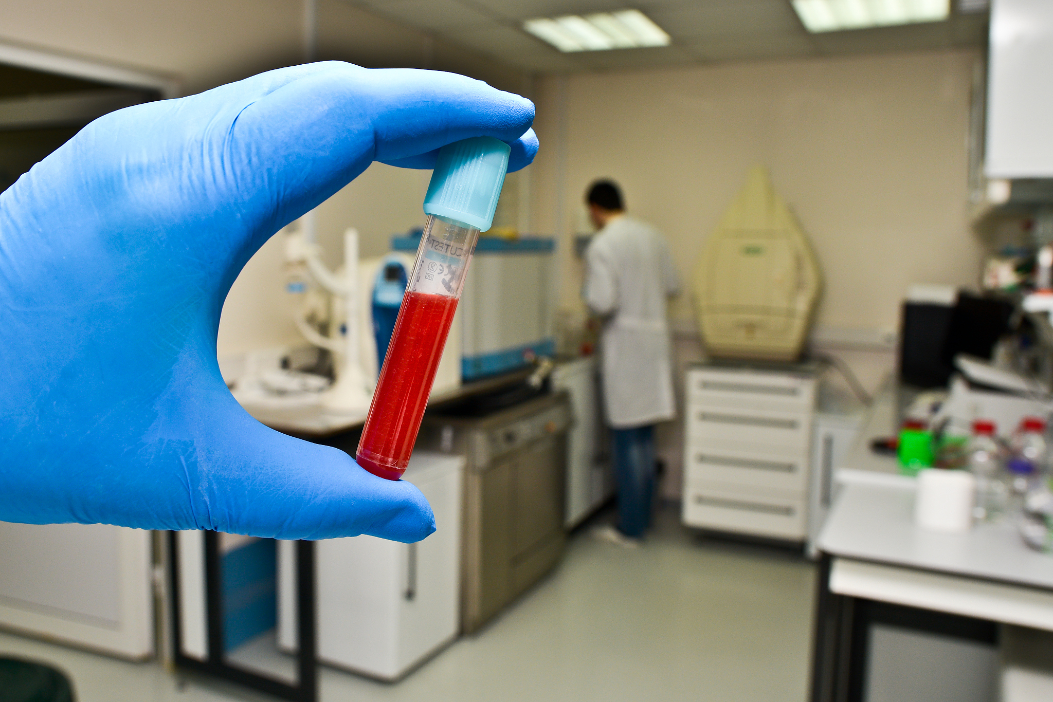 CLINICA CHIMICA ACTA 期刊研究范围：涵盖临床化学与实验室医学各个方面