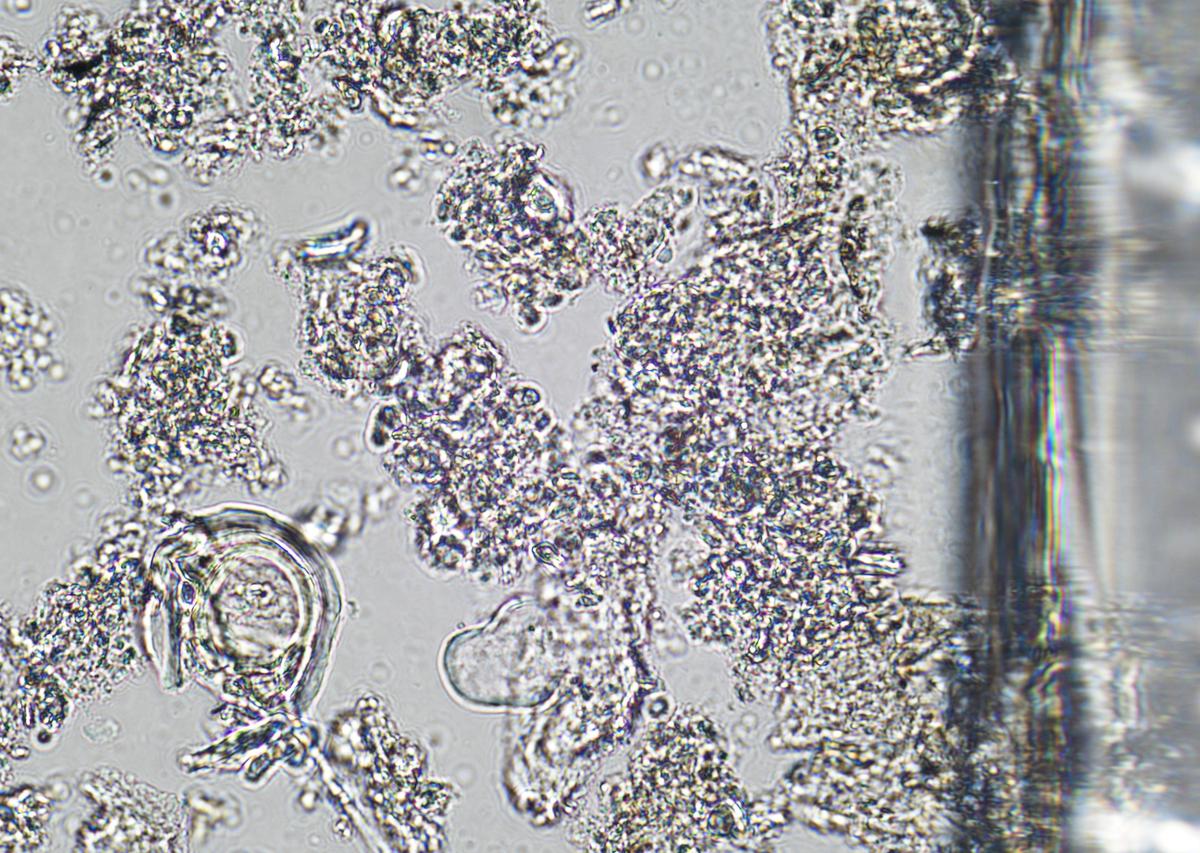 革兰氏阴性细菌外膜蛋白定位预测:ES面还是PS面? 革兰氏阴性细菌外膜蛋白定位预测:ES面还是PS面?