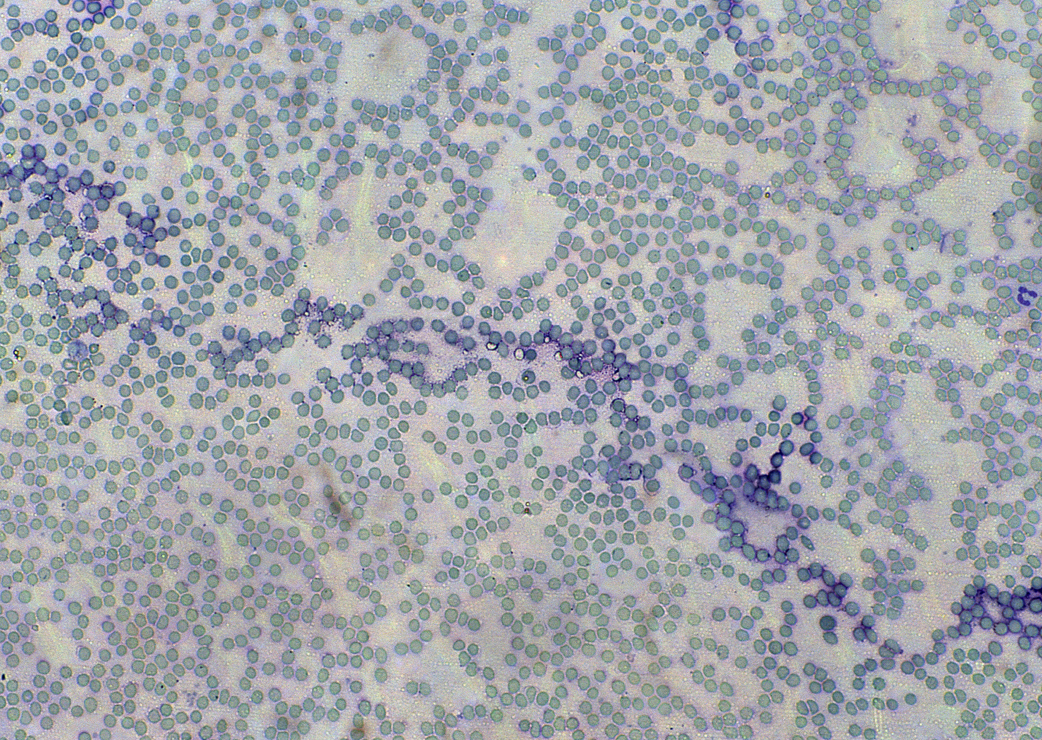 优化AT2细胞提取与培养技术: 现实意义、应用价值及未来展望