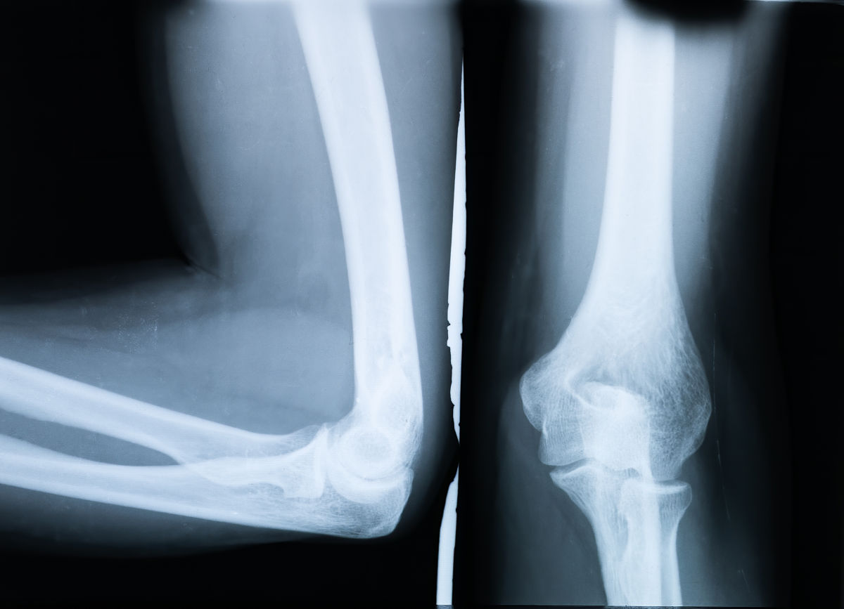 乒乓球正手攻球技术的动作要领？易犯错误和纠正方法？