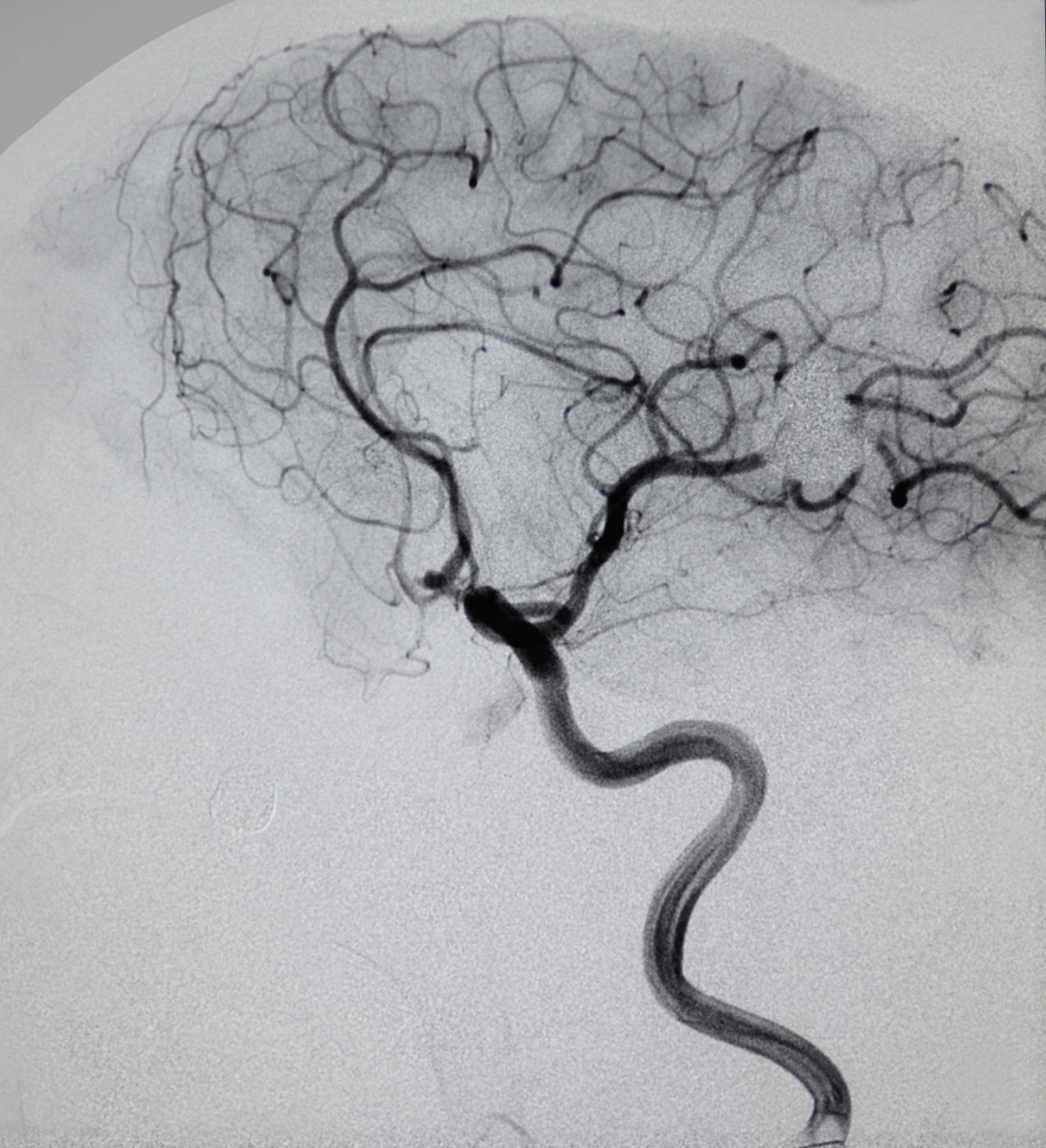 因为 CT 图像的灰度代表了不同组织对于 X 射线的吸收系数因此它可以直接用来进行CT 图像诊断这句话对吗？