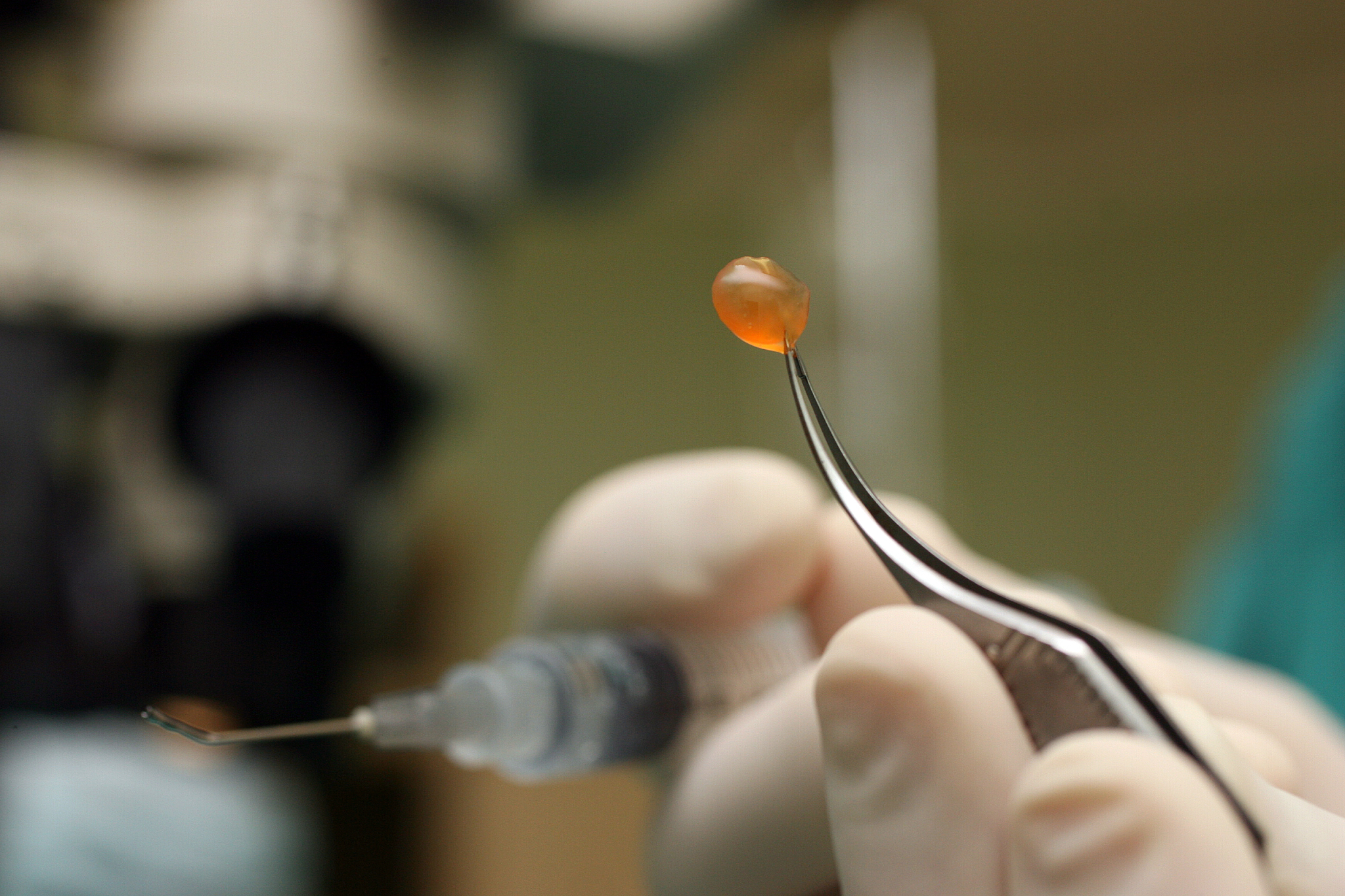 人工晶状体：生物材料与眼科手术的完美结合