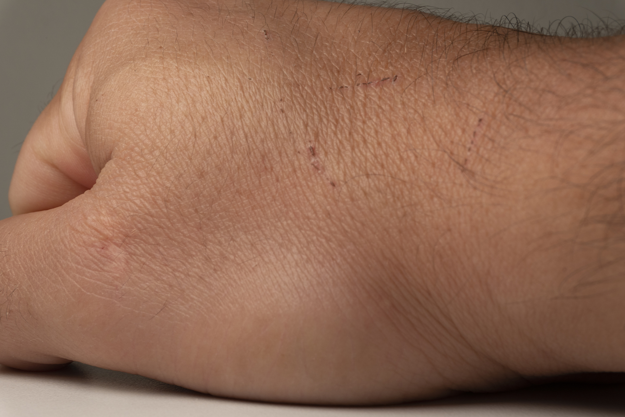 hand in detail.