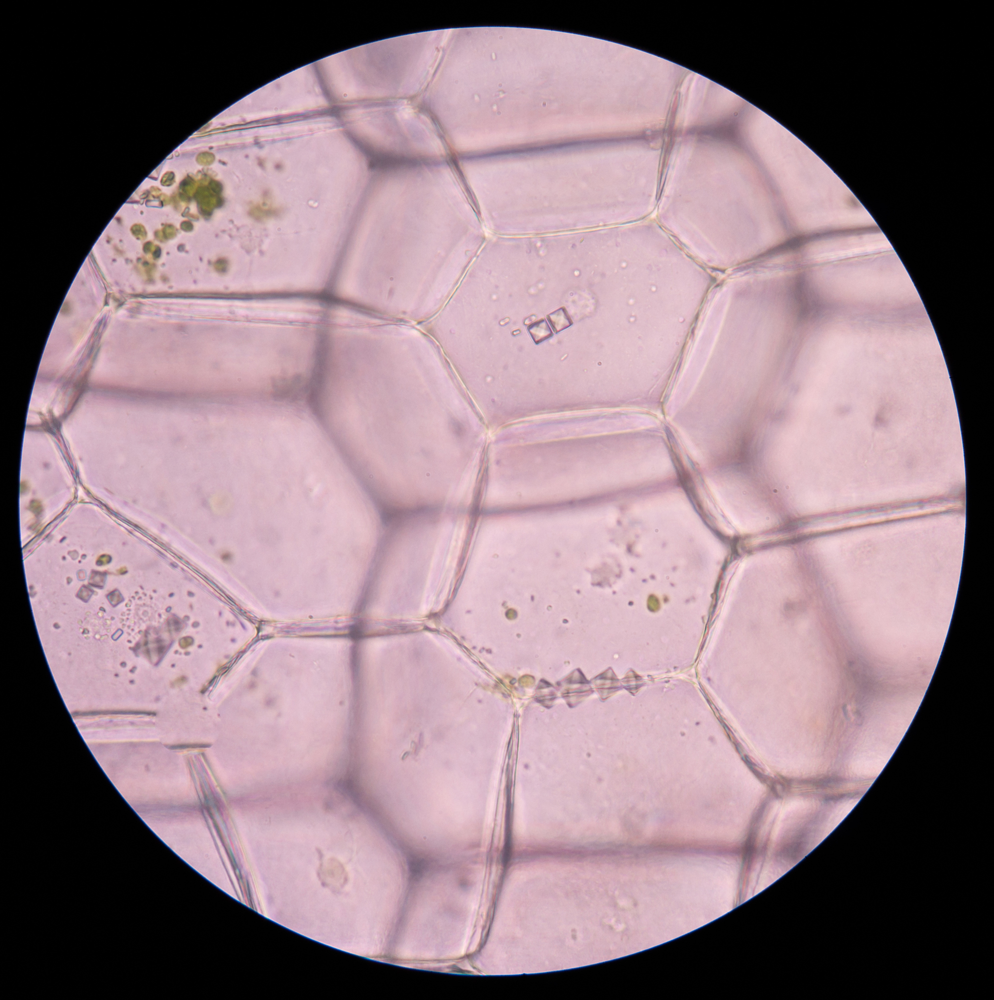 LNP 结构的最新见解：冷冻电镜、SANS 和 NMR 研究