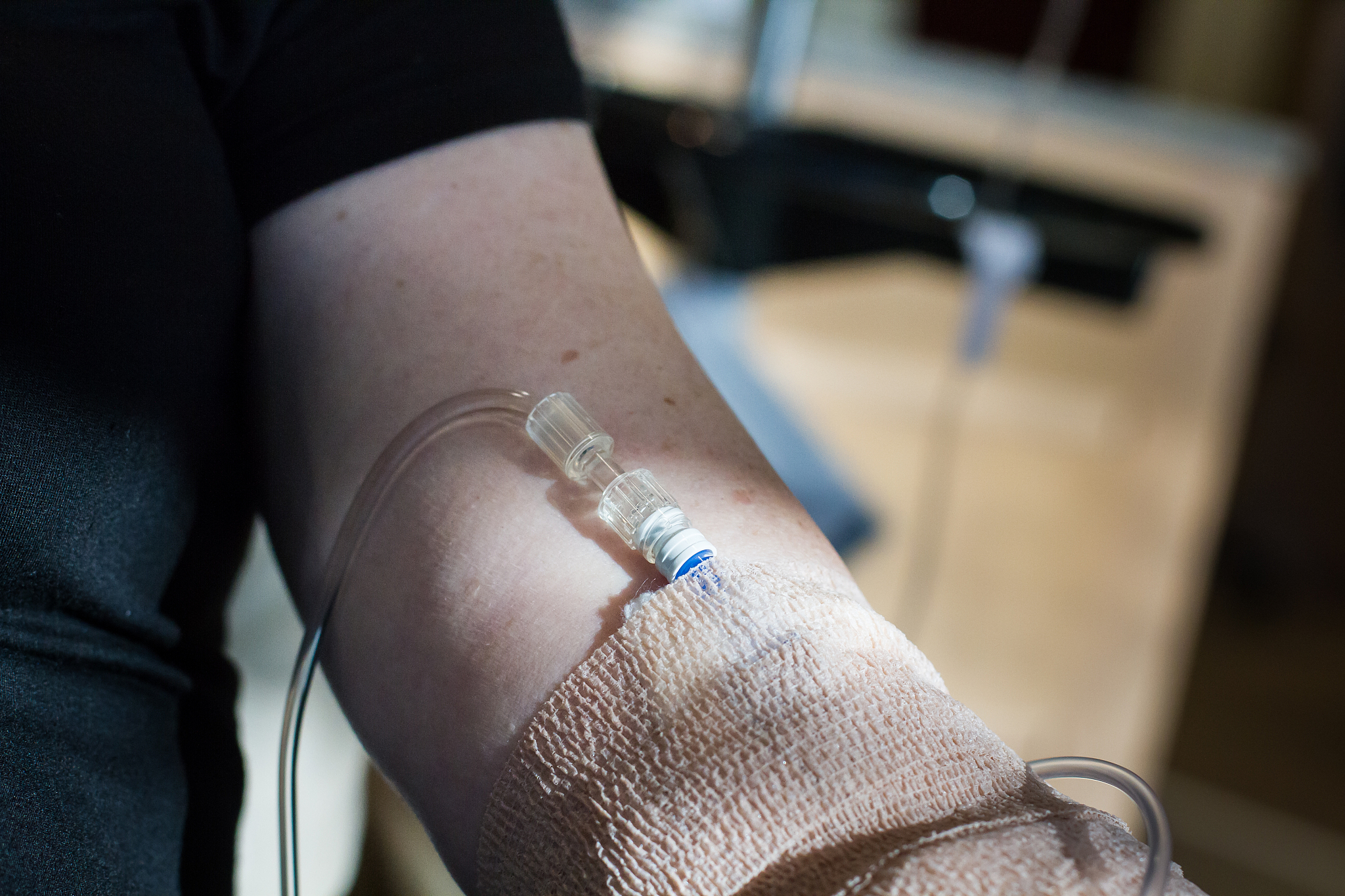 浅静脉留置针留置护理中合理选择穿刺部位