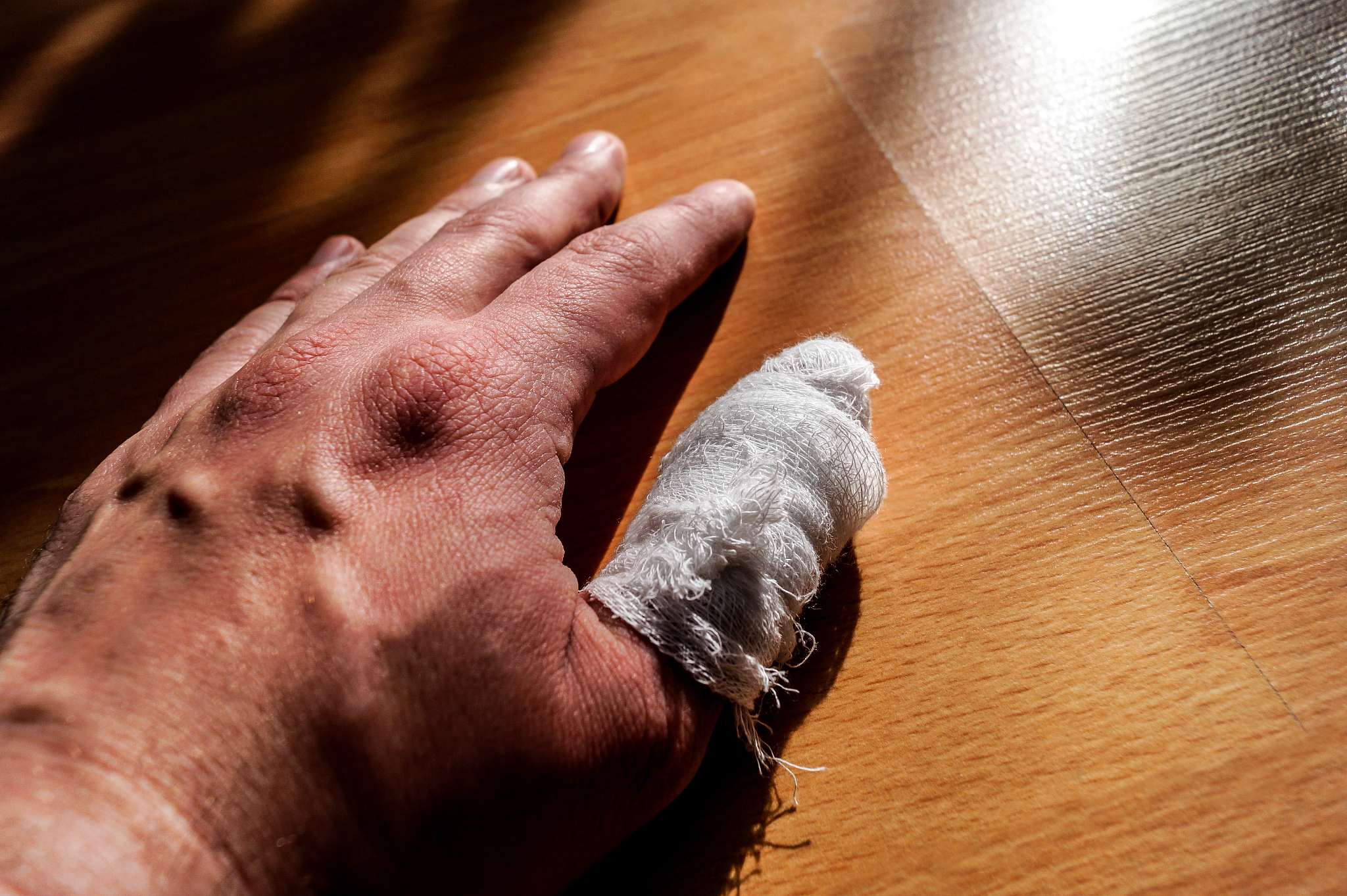 人的手被火碱腐蚀后怎么办？