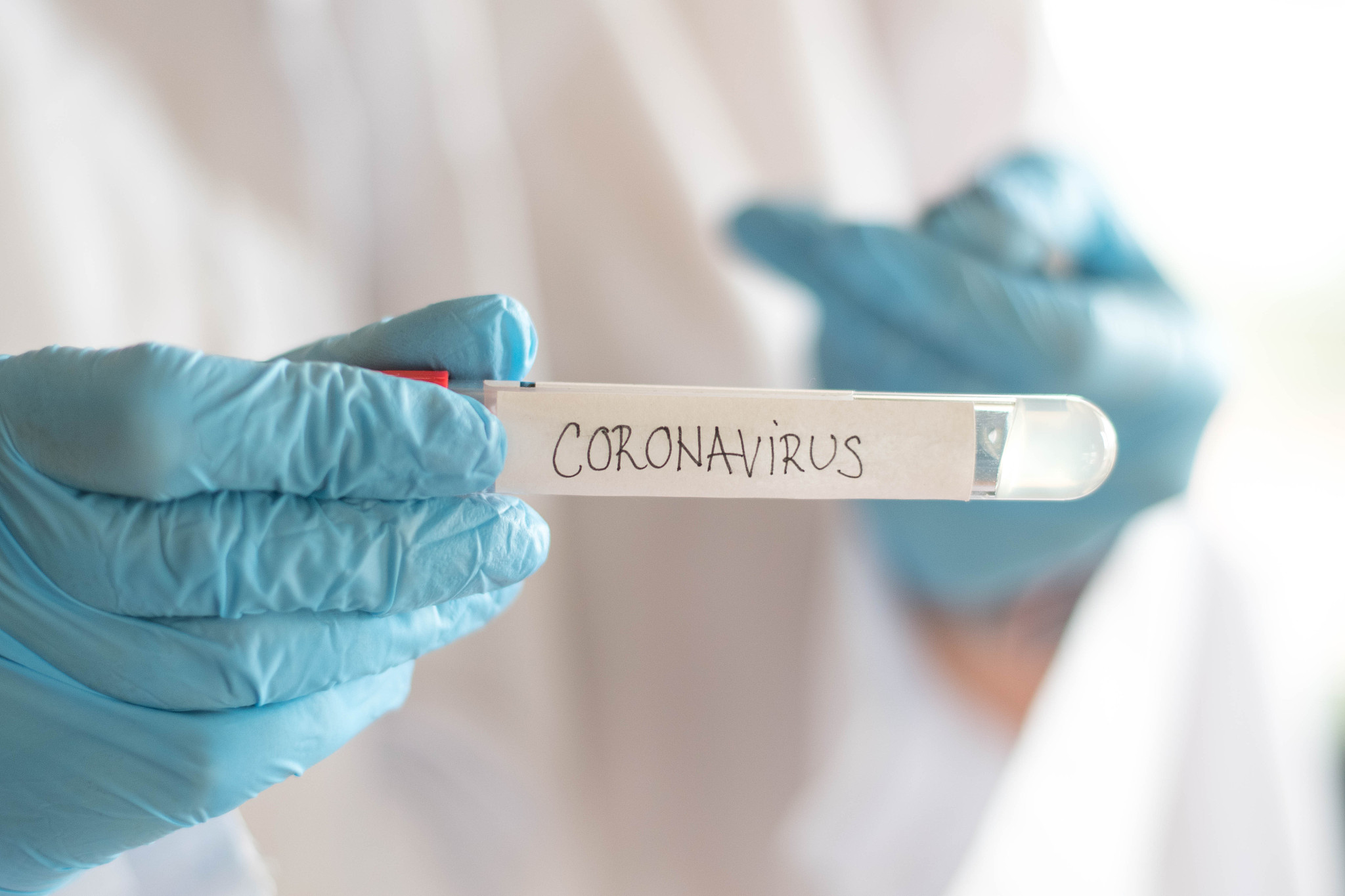 researcher holds in hands test tube with coronavirus virus, anal