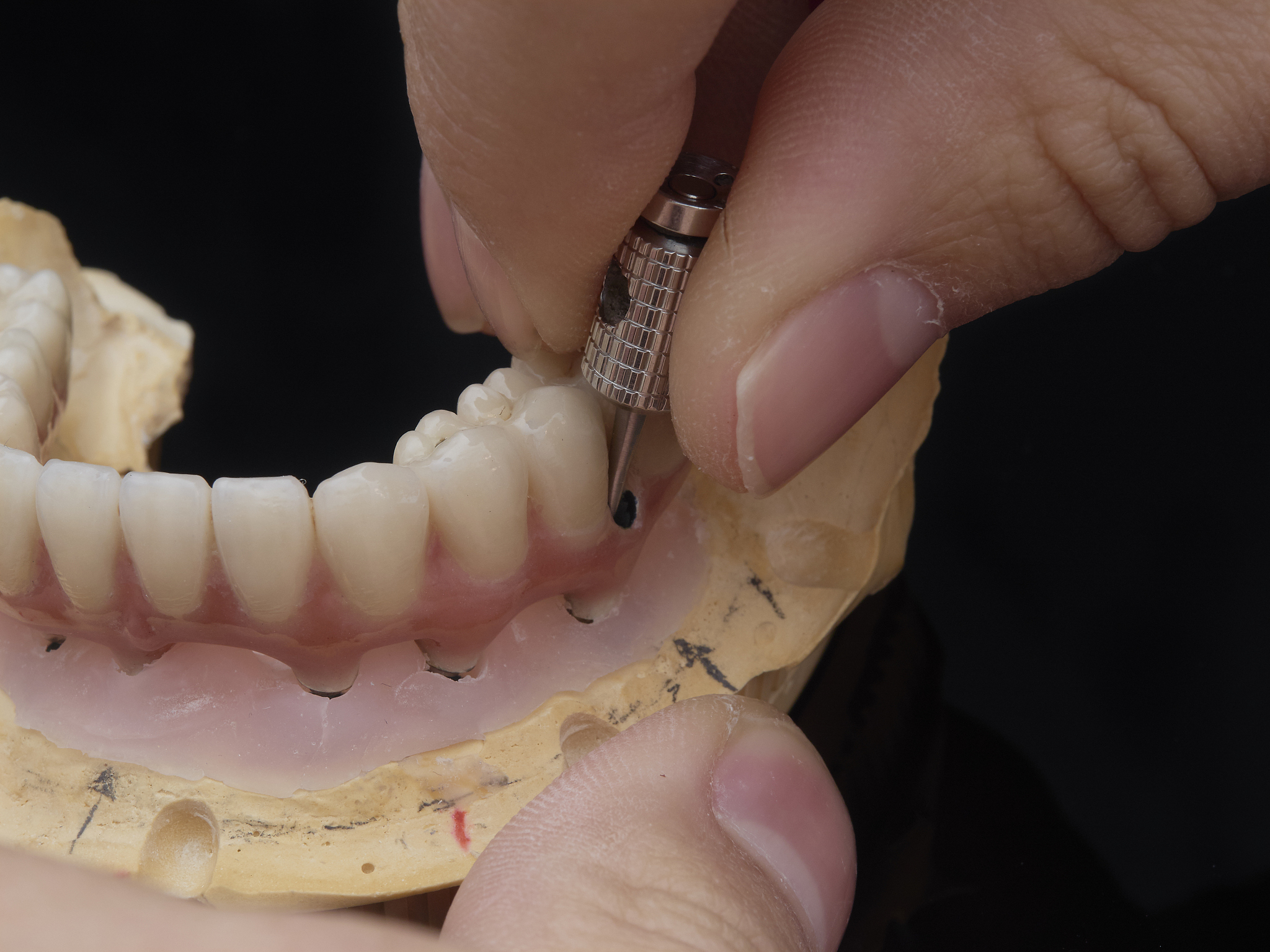 安徽省特殊教育中专学校口腔修复工艺专业介绍