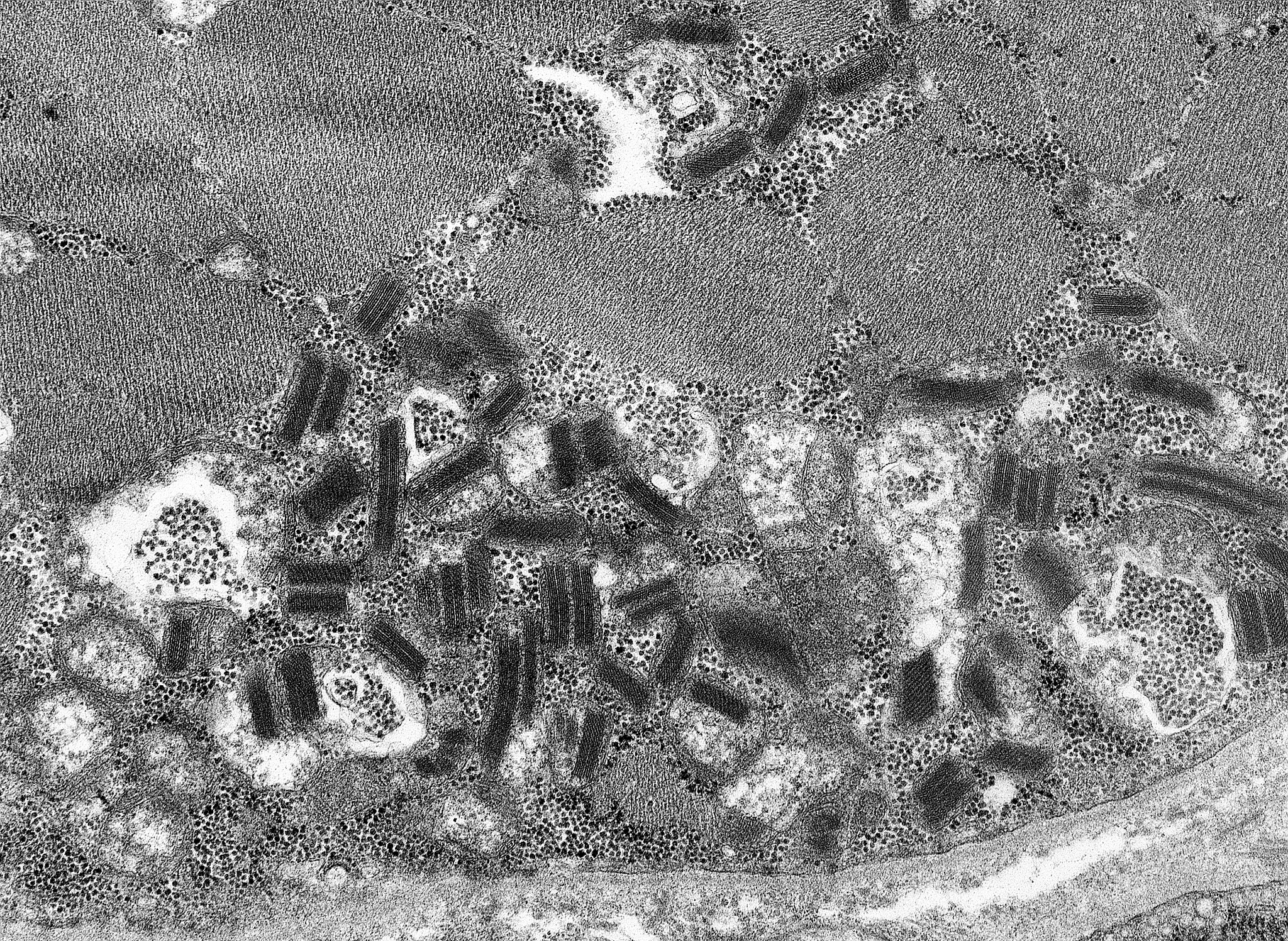 电泳/电镜图片修饰软件：提高清晰度和可视化效果