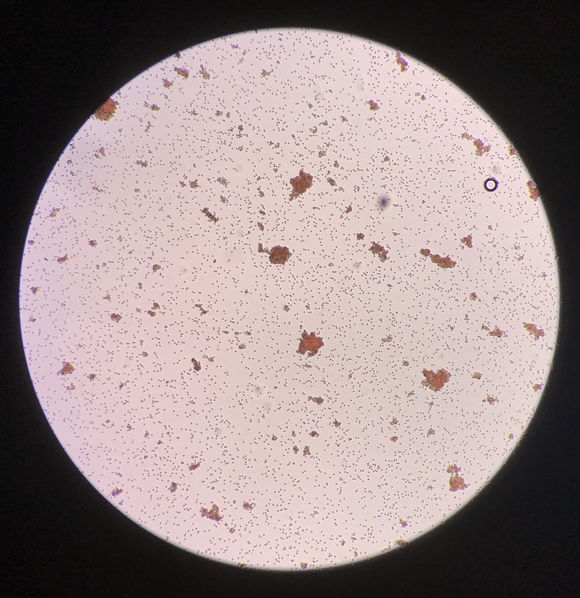Tonsil Crypt Epithelial Cells: Korean Translation