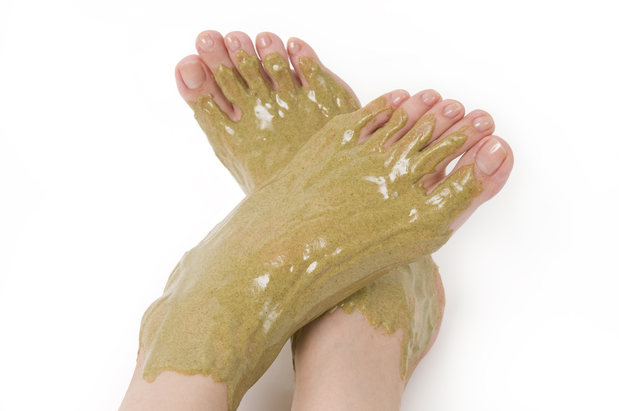 怎么治疗脚步脱皮