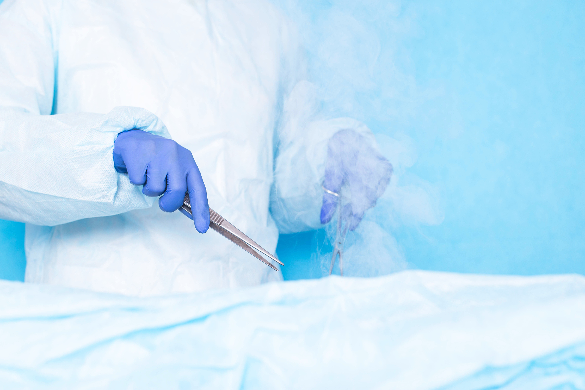 dr. cryosurgeon performs a modern operation using liquid nitroge