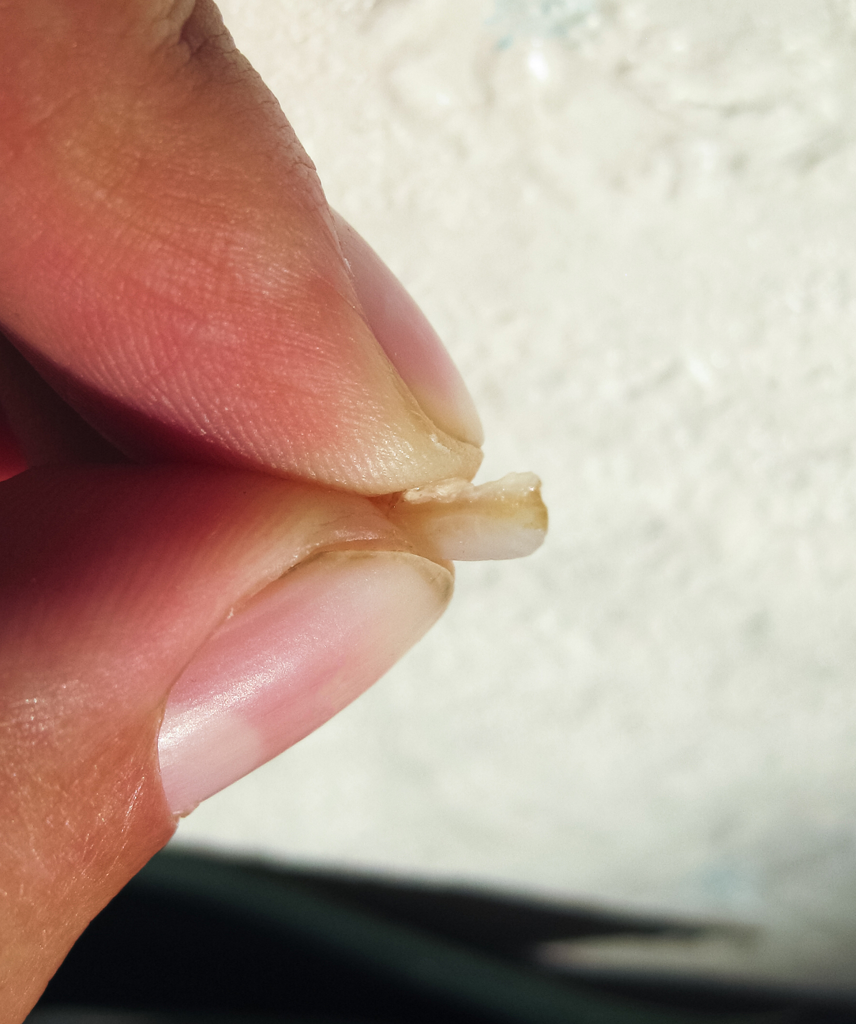 指甲盖痒怎么办？缓解方法及注意事项