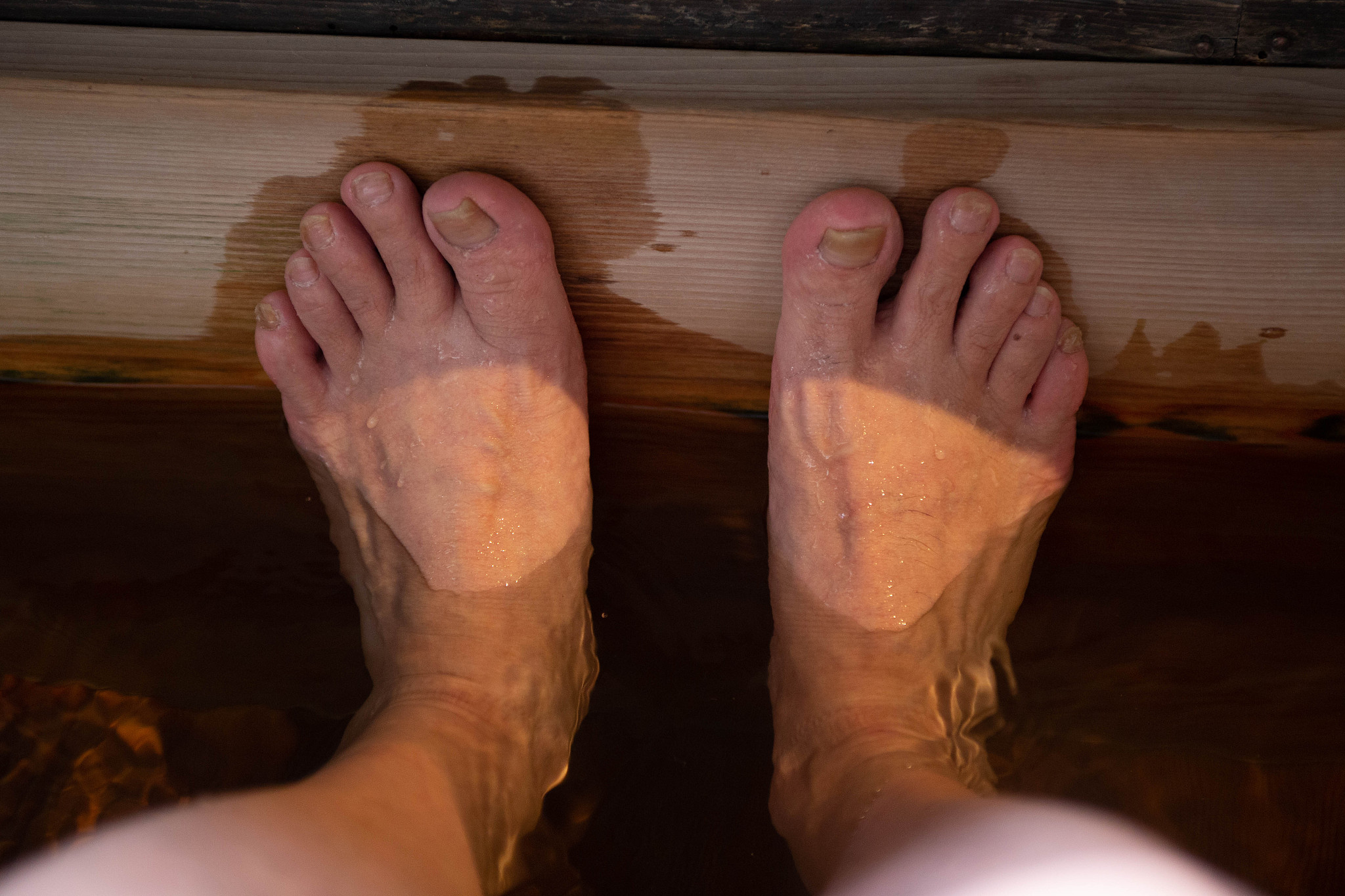 脚为什么容易出汗