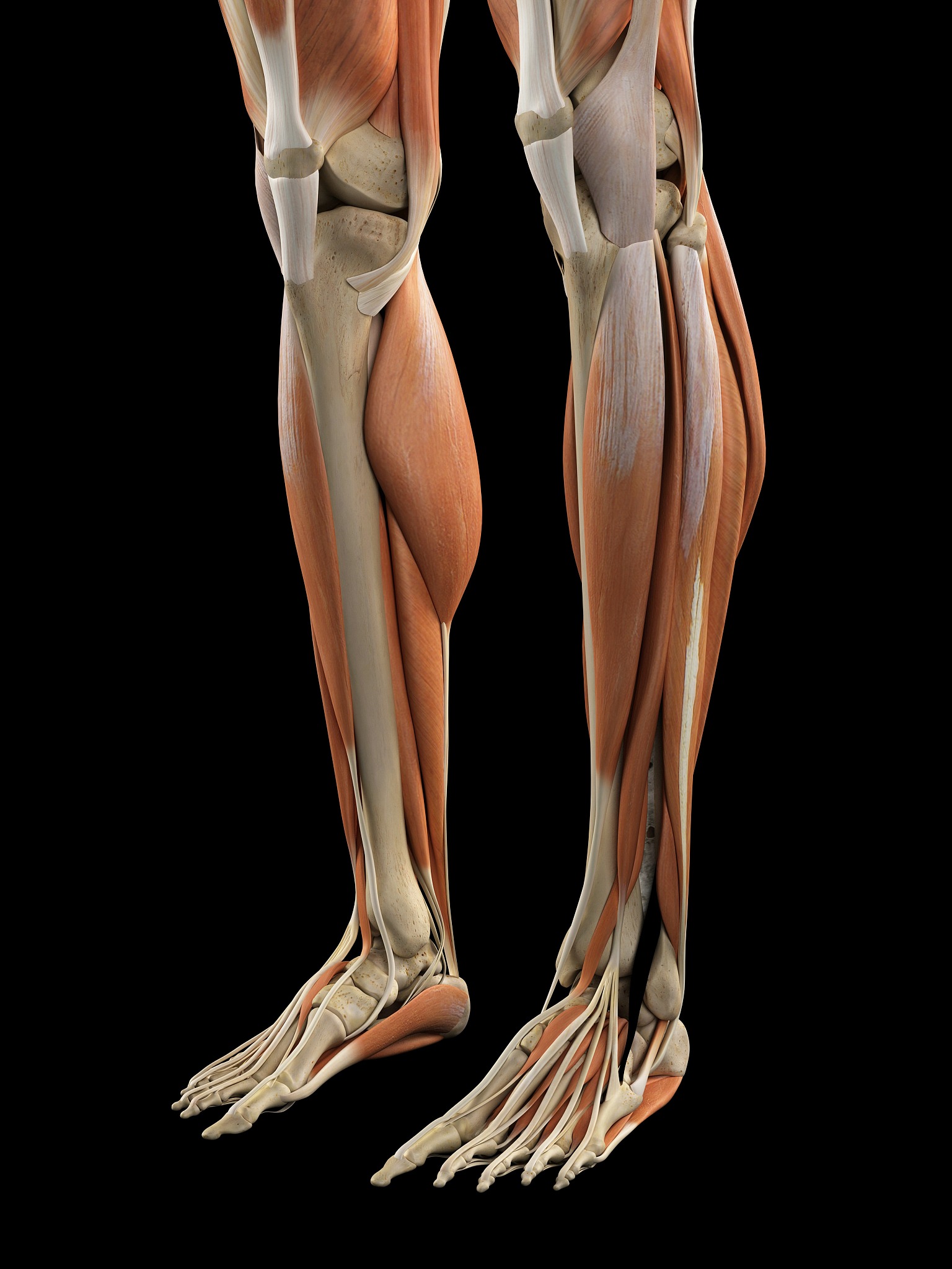 小腿弯曲可以矫正吗，