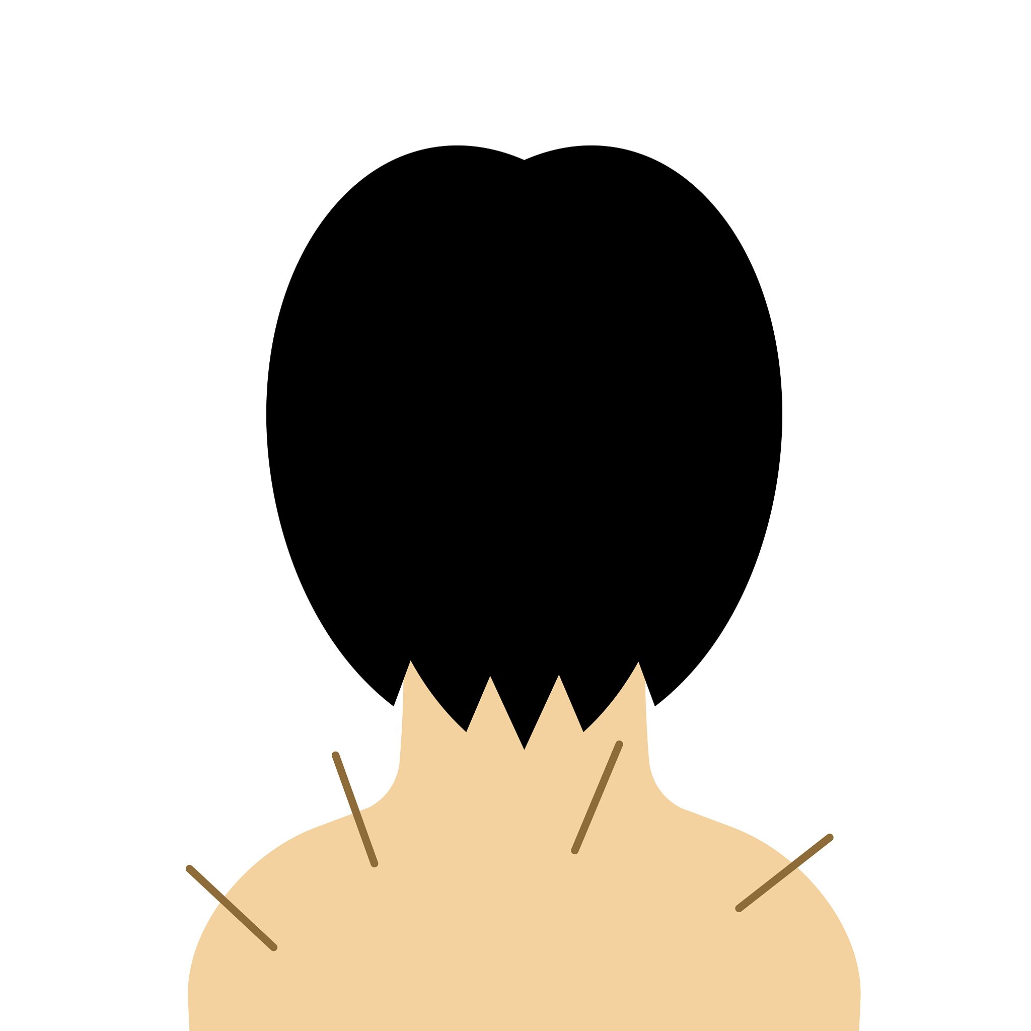 acupuncture treatment