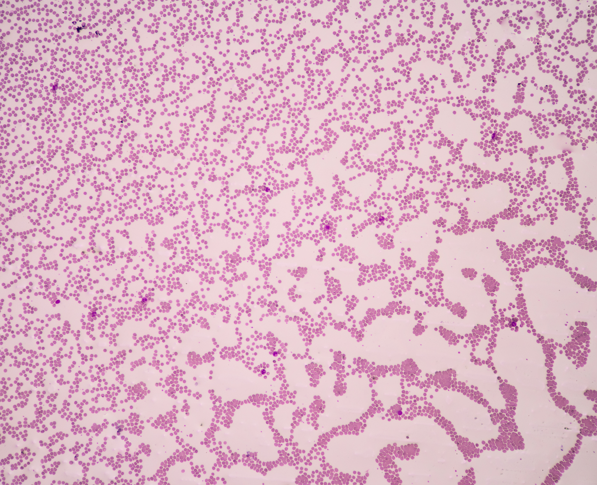 HE染色：清晰诊断的利器 - 优势与应用