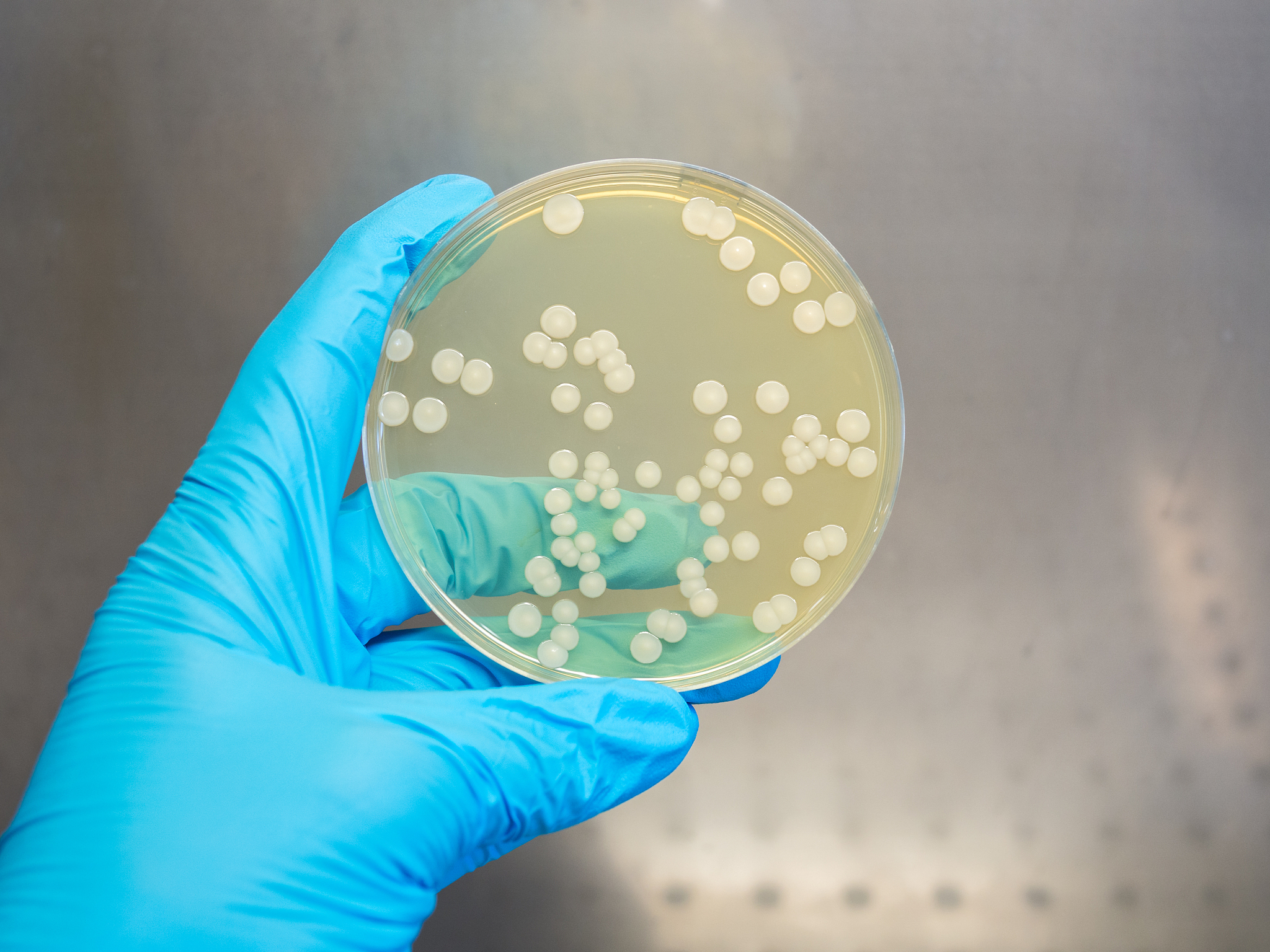 手部和手机触摸屏微生物菌群分析实验报告