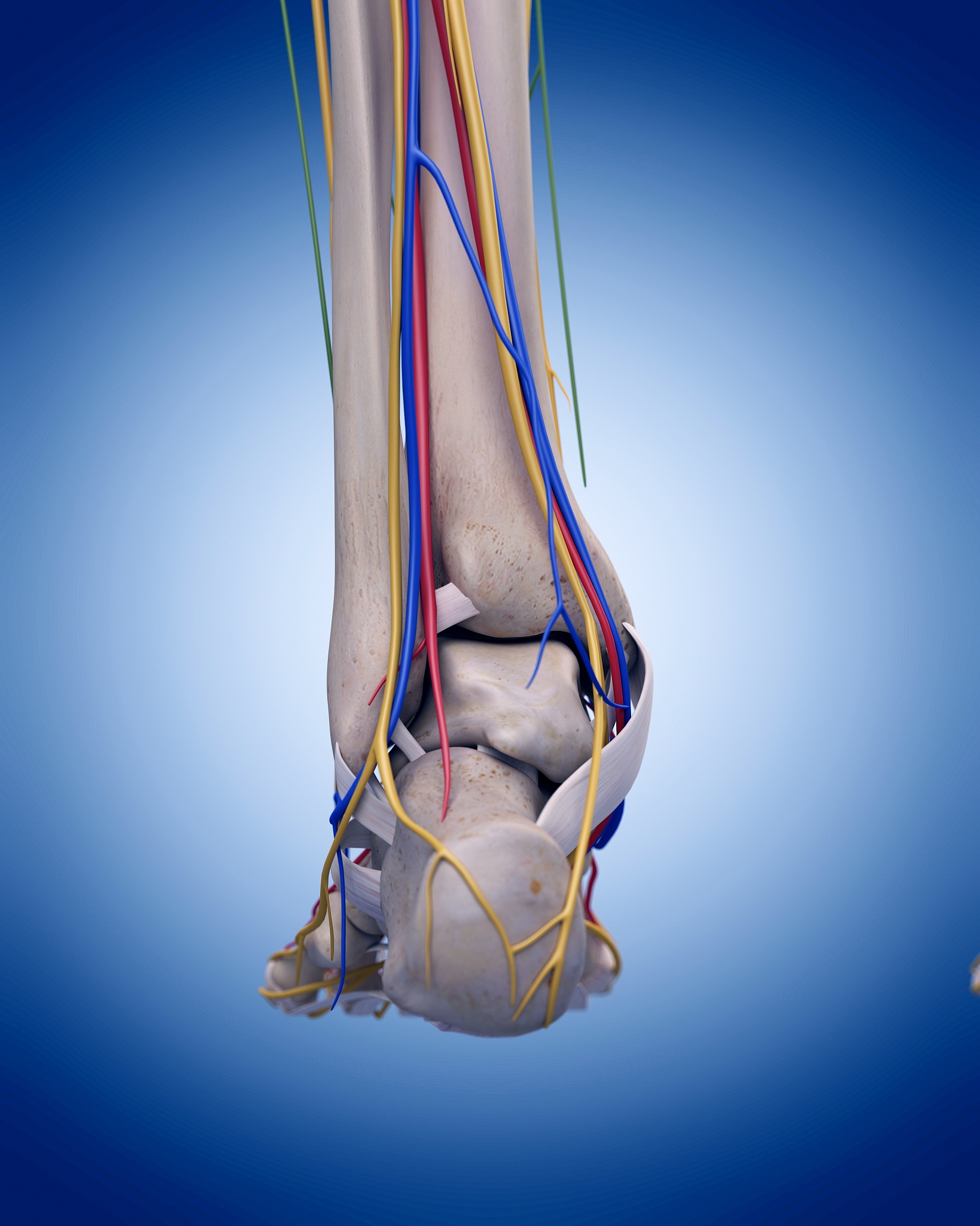 手术的目的是恢复踝关节外侧副韧带复合体的连续性 达到其限制踝关节活动时距骨的过度内翻和前移的自由度 从而避免继发关节内软骨的损伤等一系列并发症。换种说法