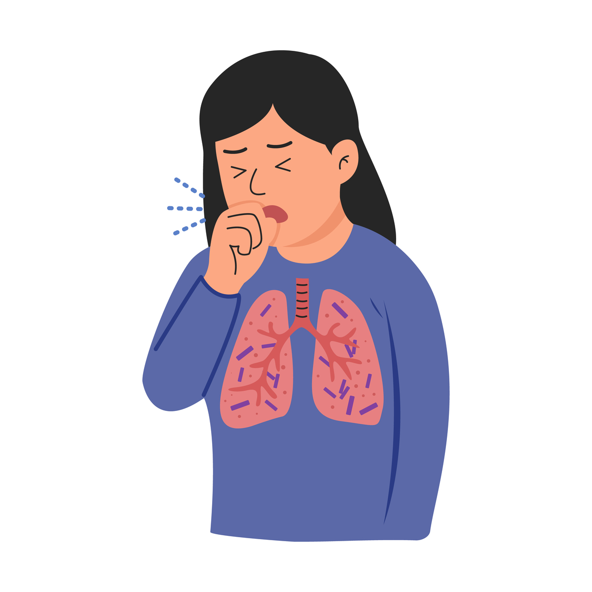 慢性喘息性支气管炎