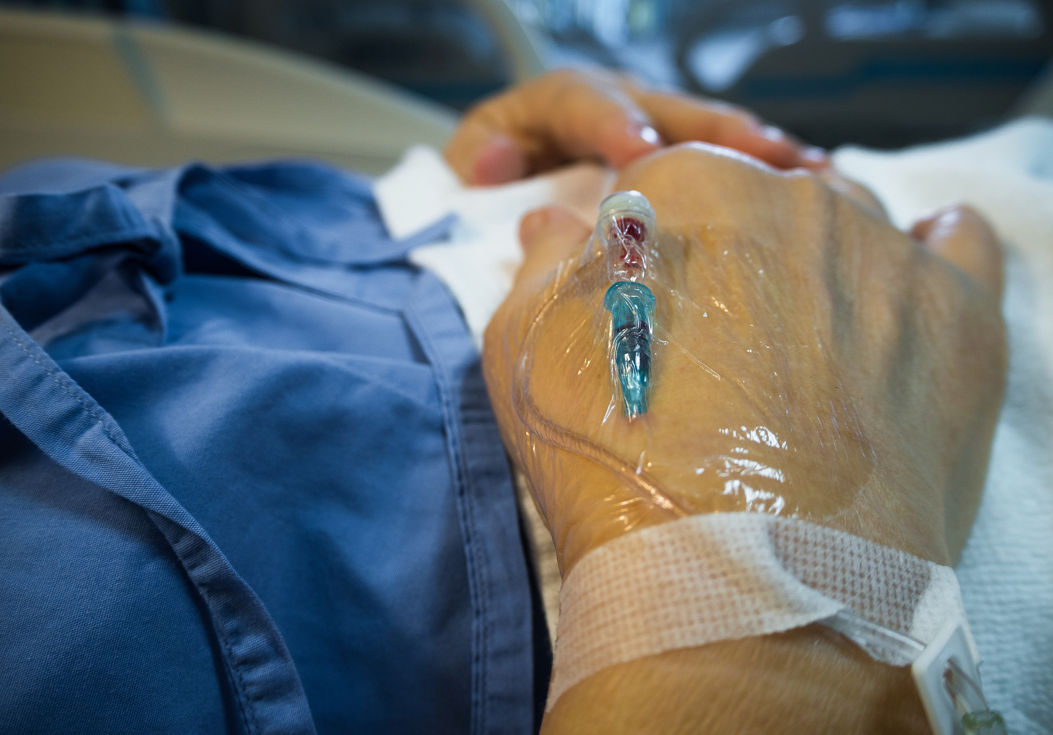 hand of the patient.