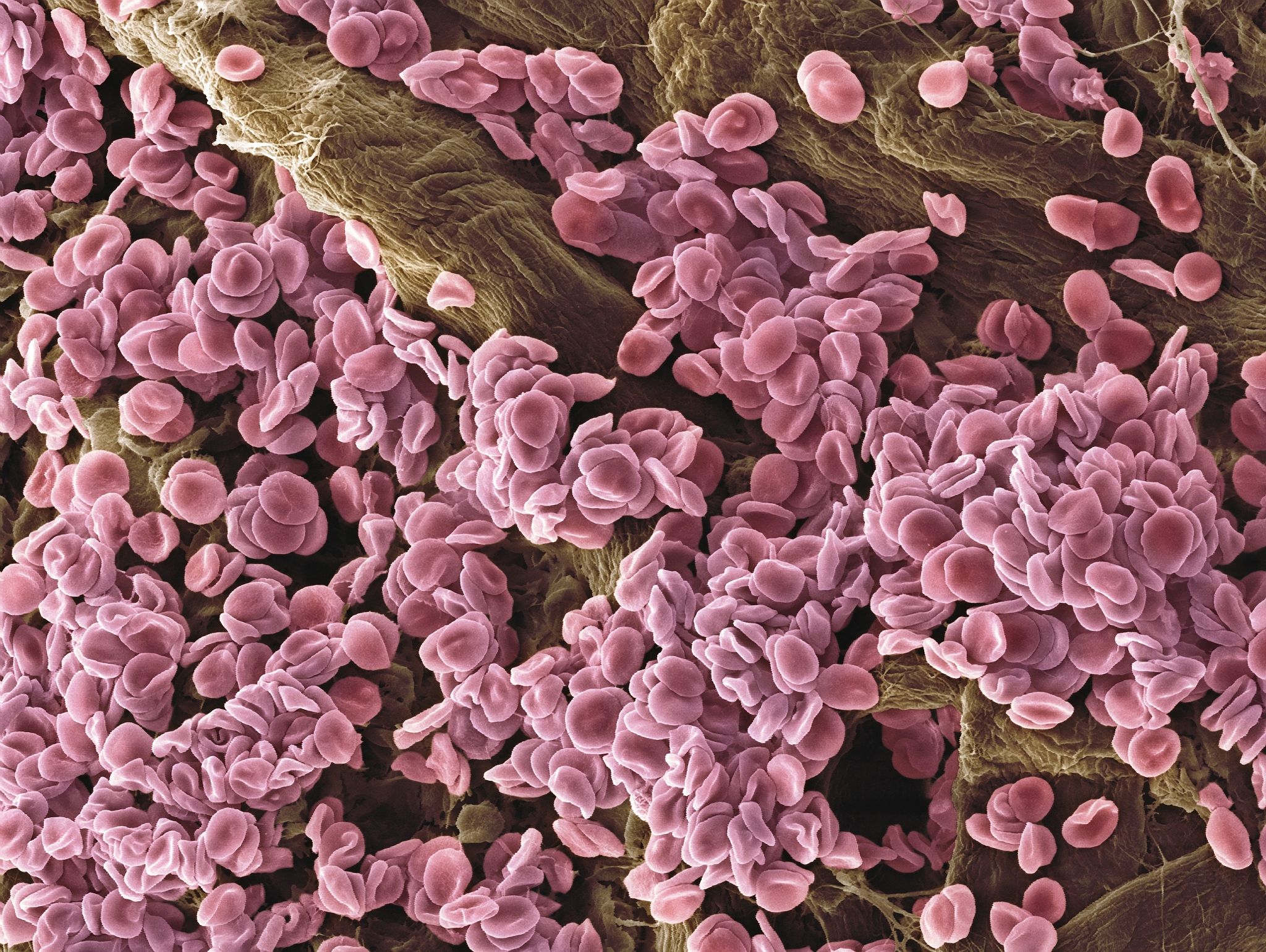 人类肠病毒EV71可感染免疫细胞通过血液循环及淋巴细胞再循环的作用扩散至其他组织器官但目前还未确定该机制是否存在于猪肠病毒中检查语病并润色