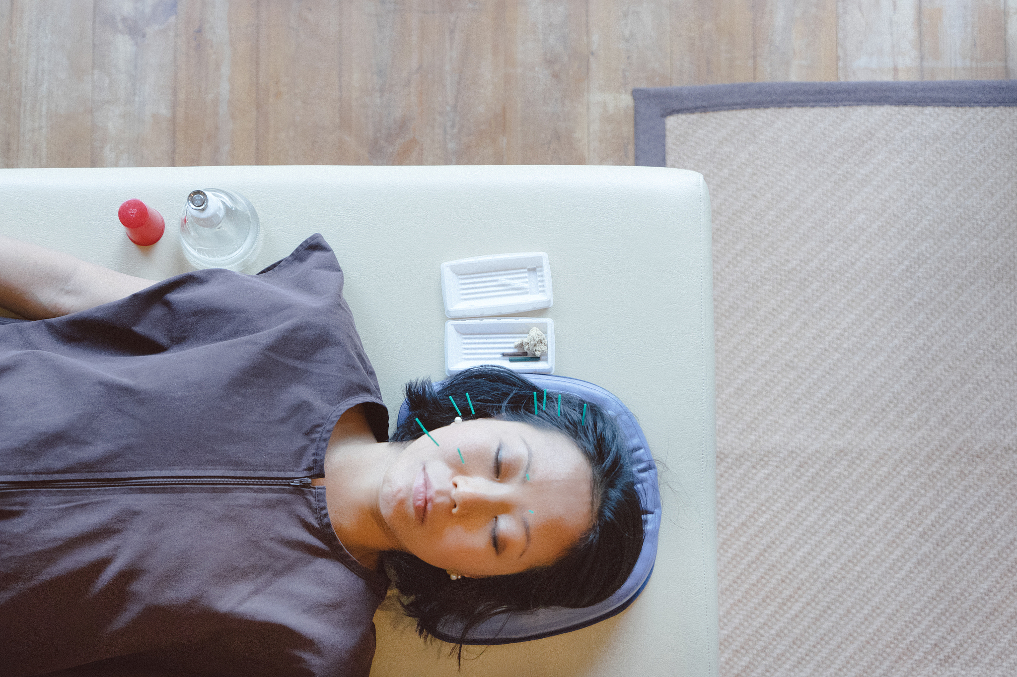 patient receiving acupuncture treatment