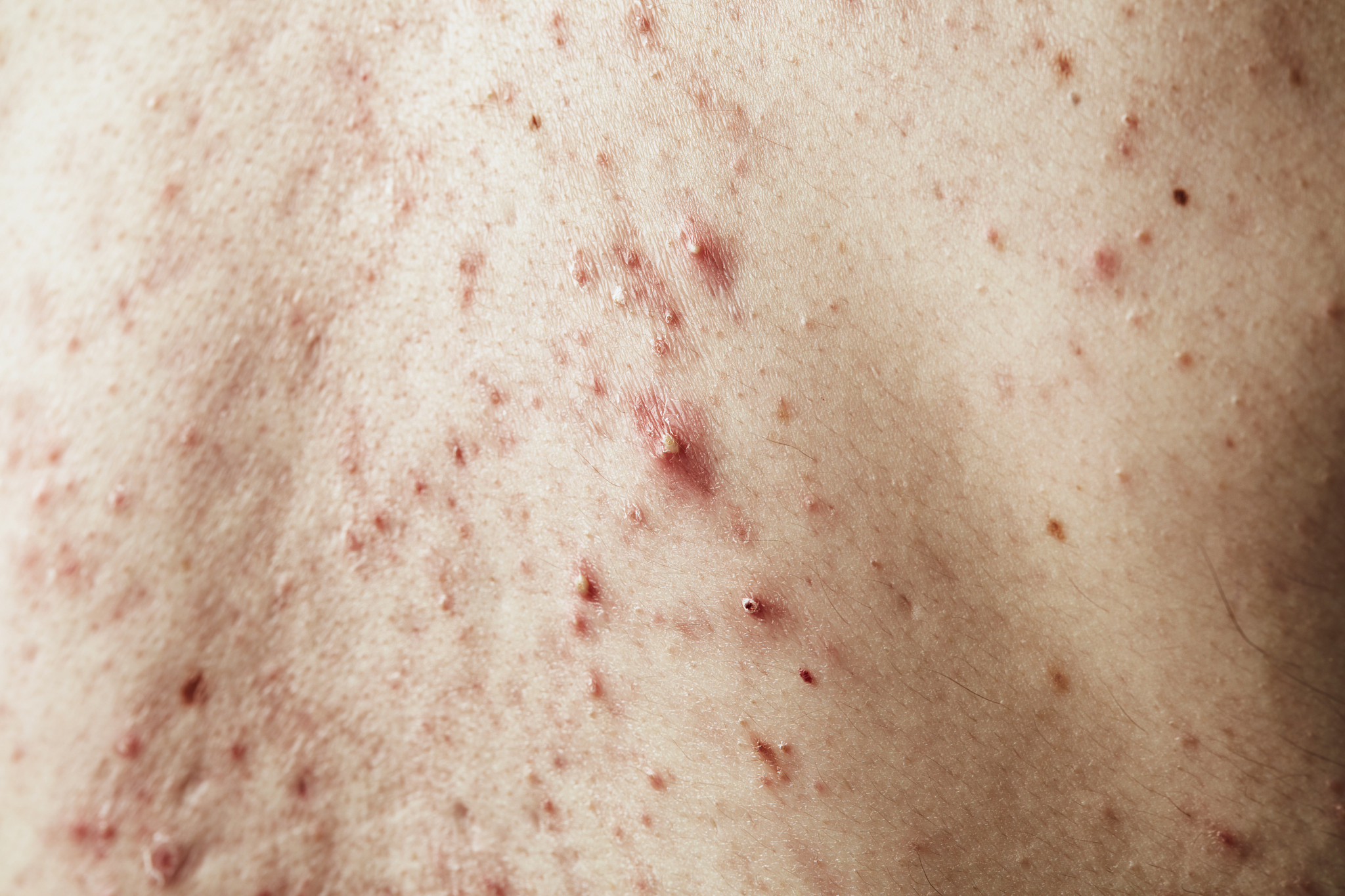 skin problems