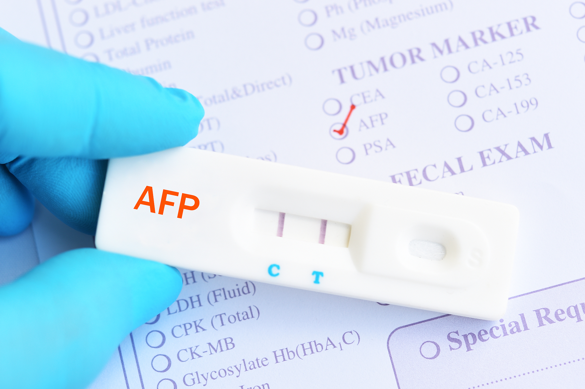 宫颈癌PD-L1阳性率