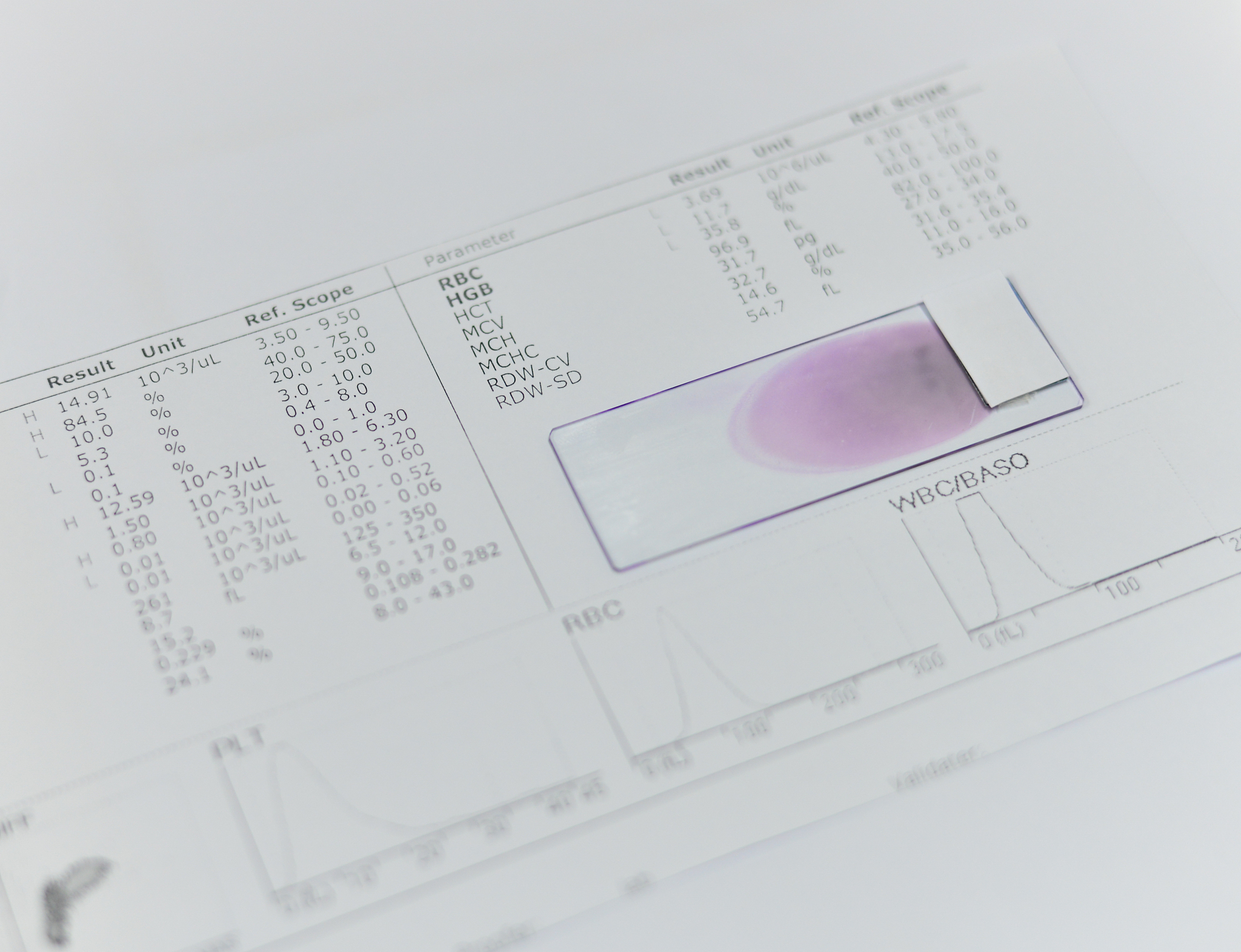 HepG2 细胞油酸诱导培养液配制方法