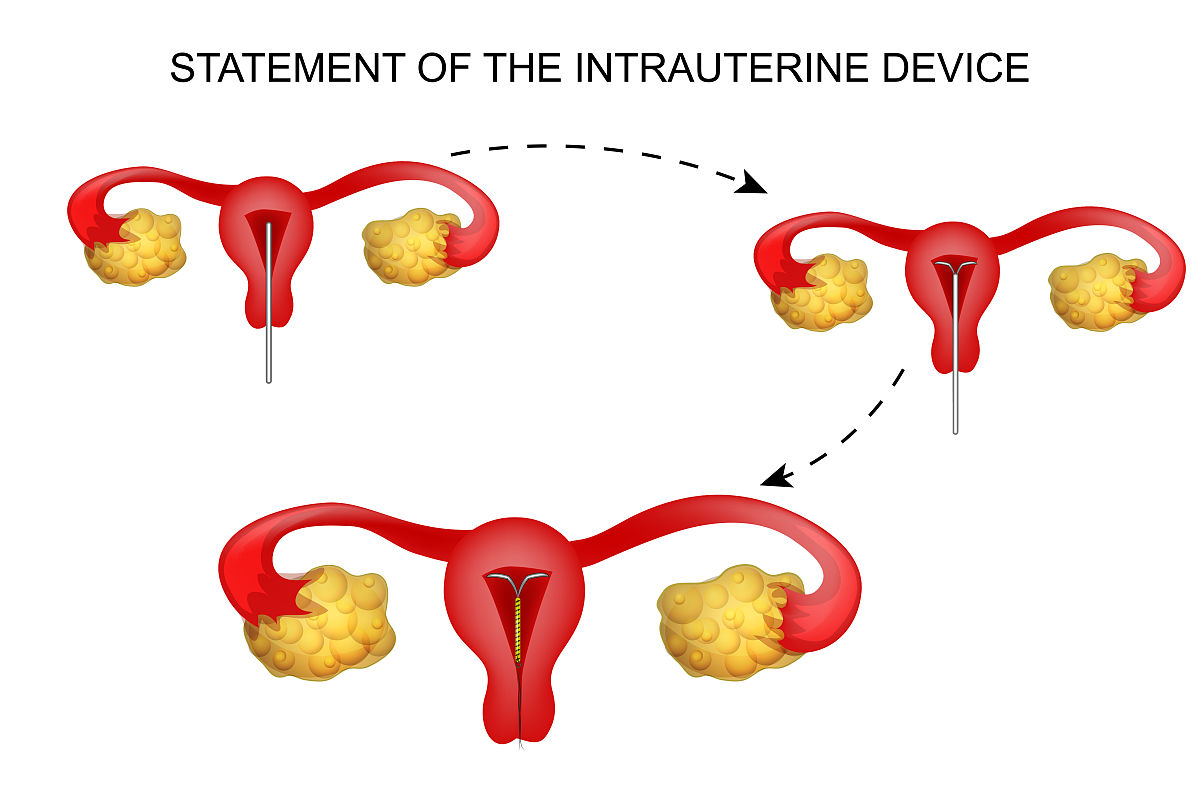 请用专业、科学和地道的中文表达如下内容：Conceptus embryofetus and placental membranes survival and growth is dependent on the uterus During early pregnancy the endometrium synthesizes and secretes as well as selectively