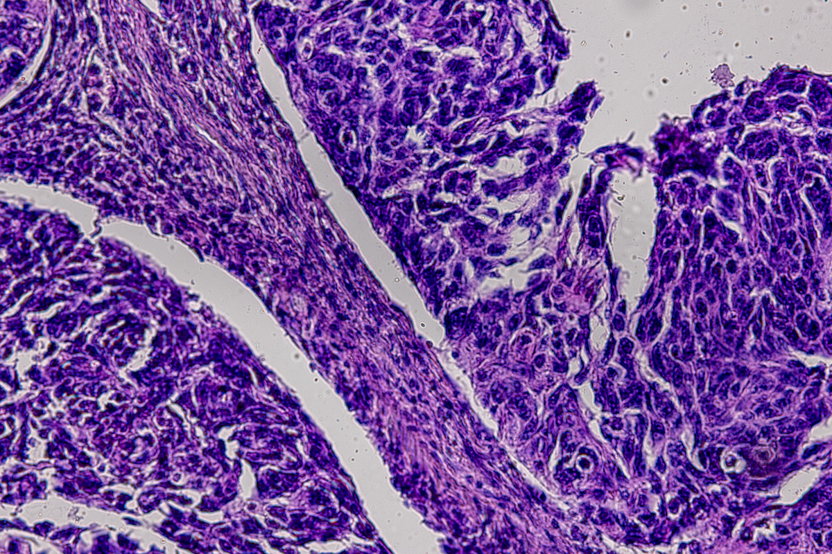 去细胞化人胎盘促进肝化：一项新的肝脏再生策略