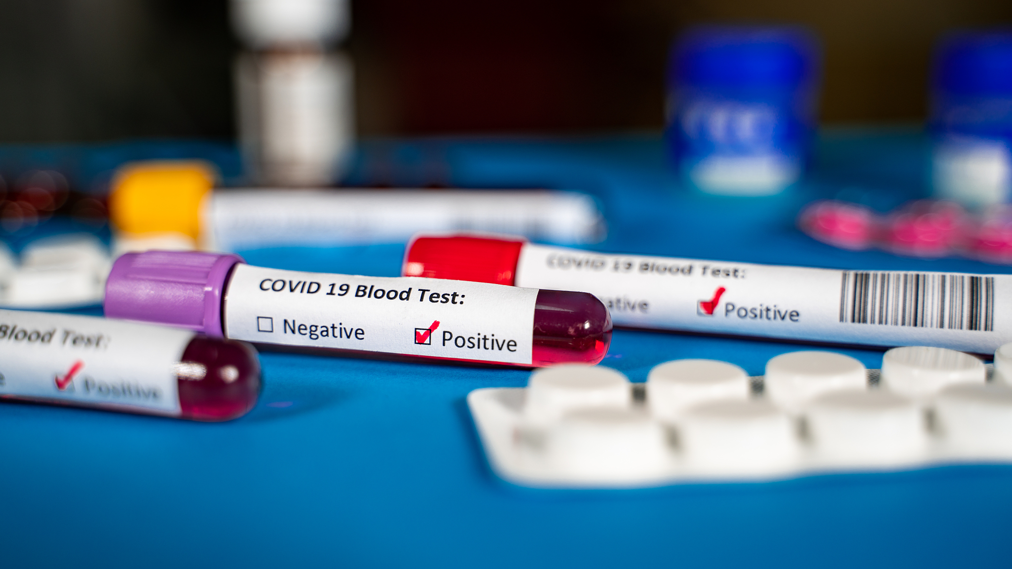 山西药科职业学院物流管理专业如何好学吗-怎么样