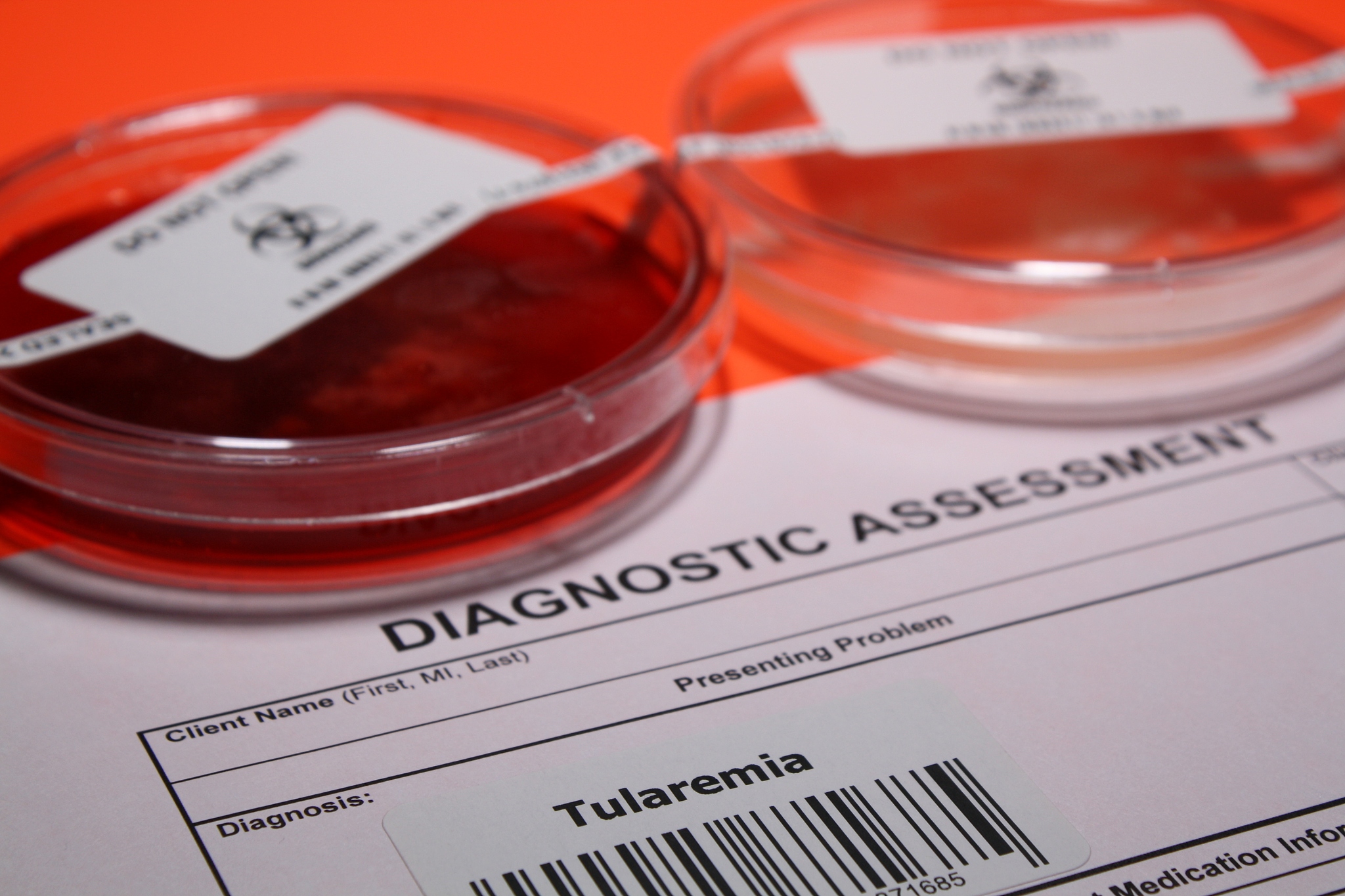 亮妍日霜能否改善肤色不均问题？