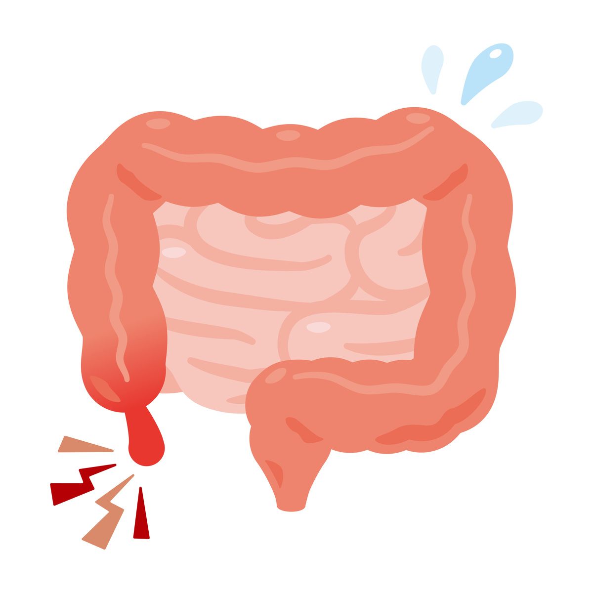 放屁是正常的吗？关于放屁的健康知识