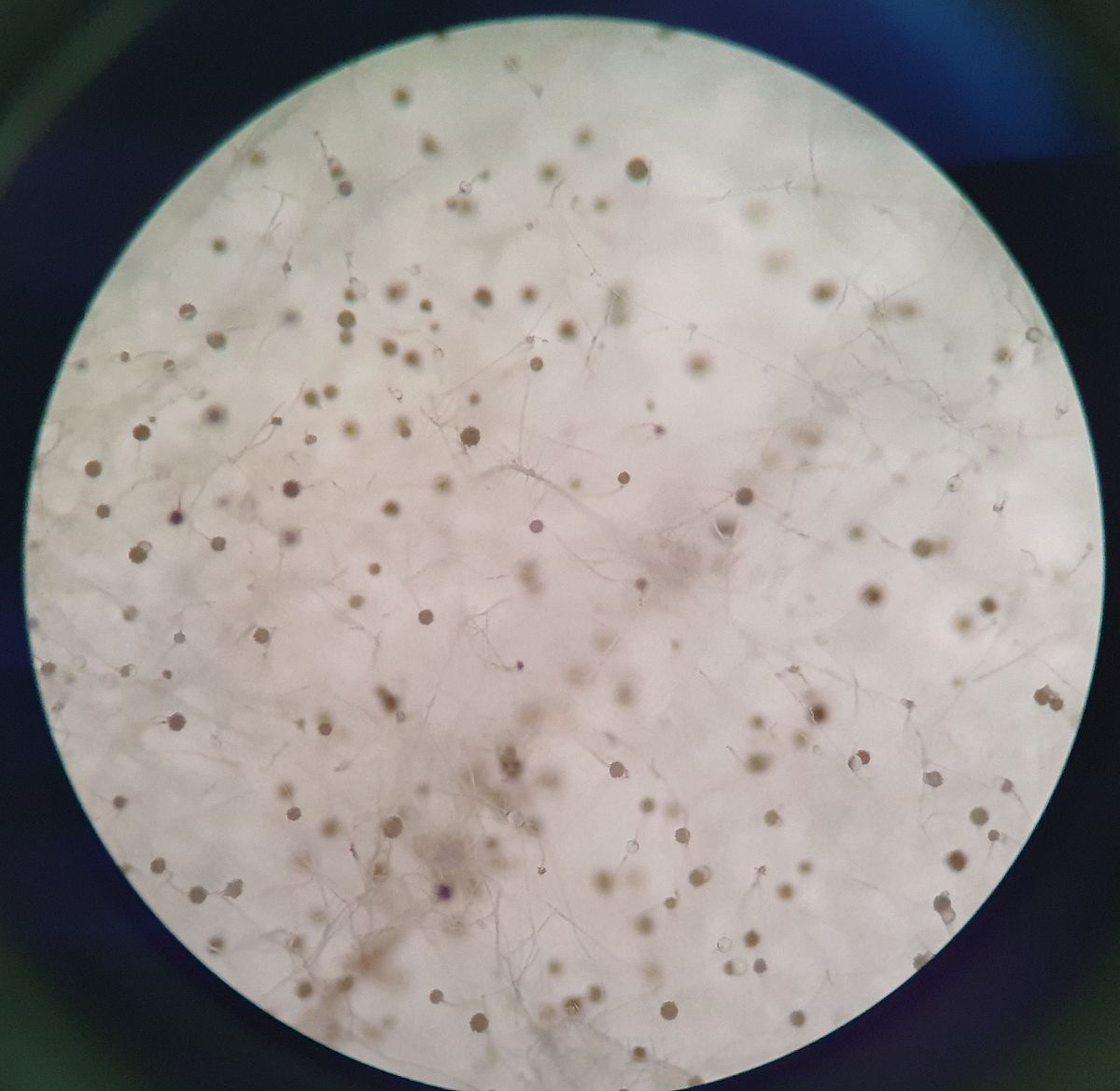 组氨酸营养缺陷型鼠伤寒沙门氏菌培养条件优化