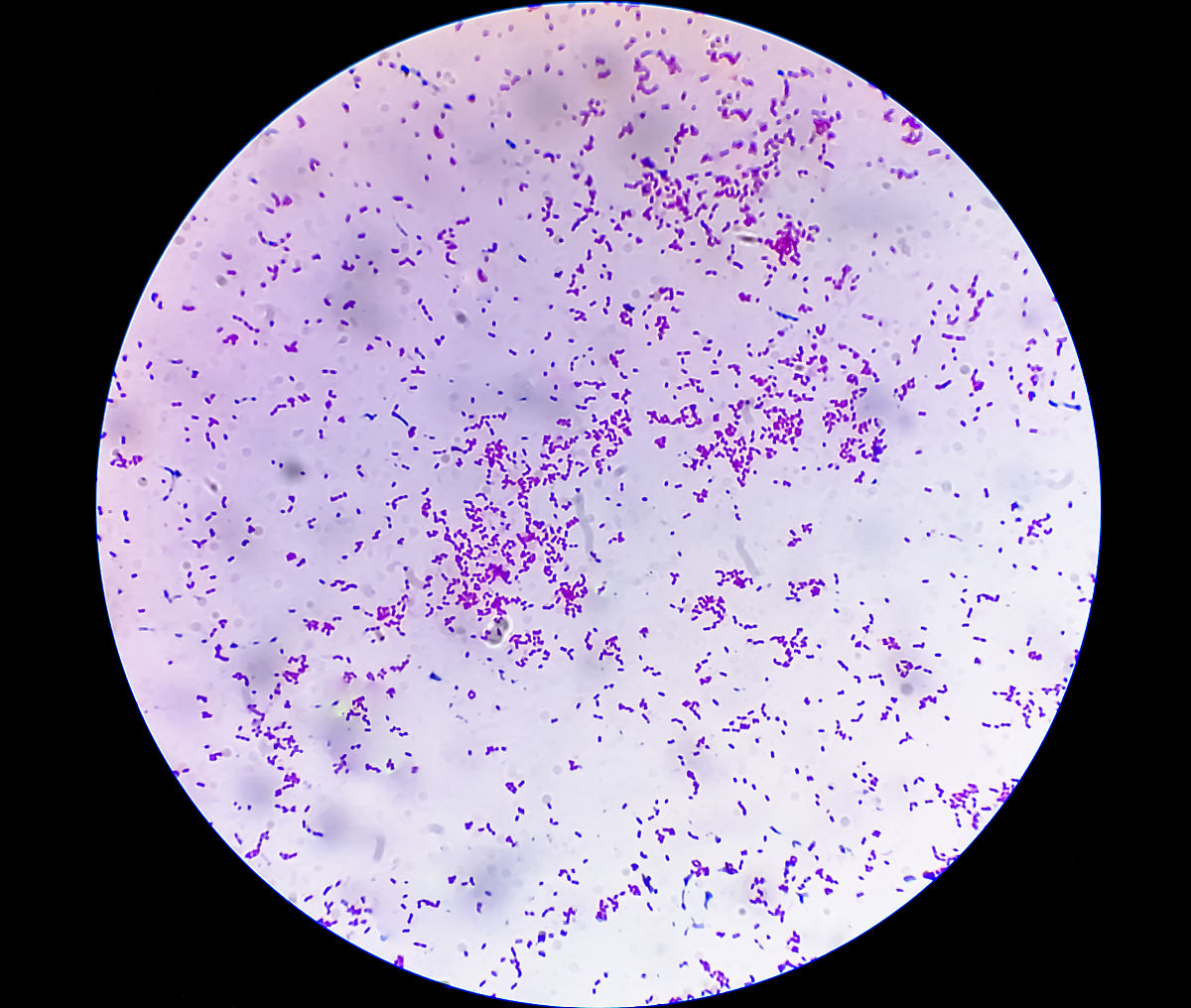 革兰氏染色结果描述与分析