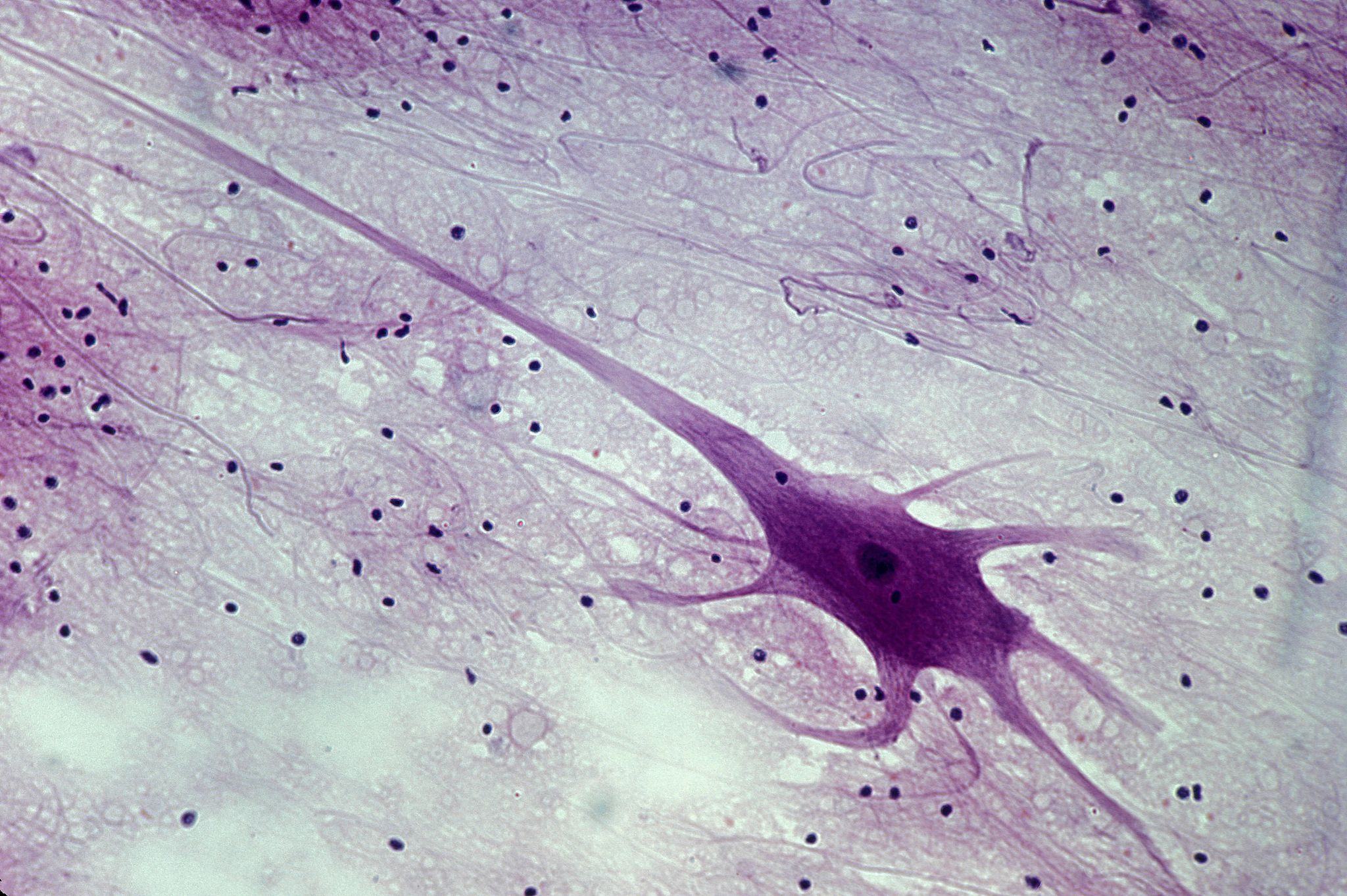 最近的太阳黑子周