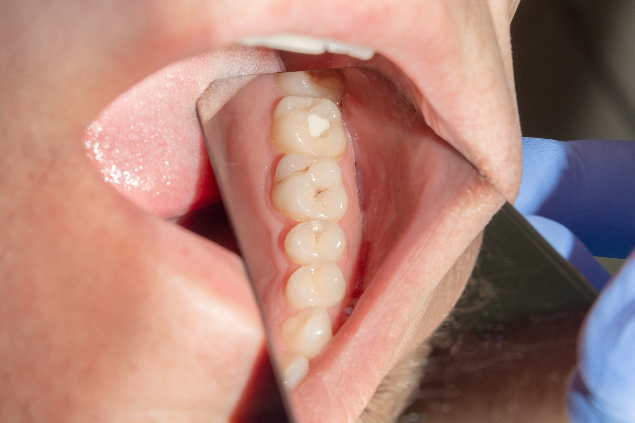 雅安职业技术学院口腔医学技术专业招生