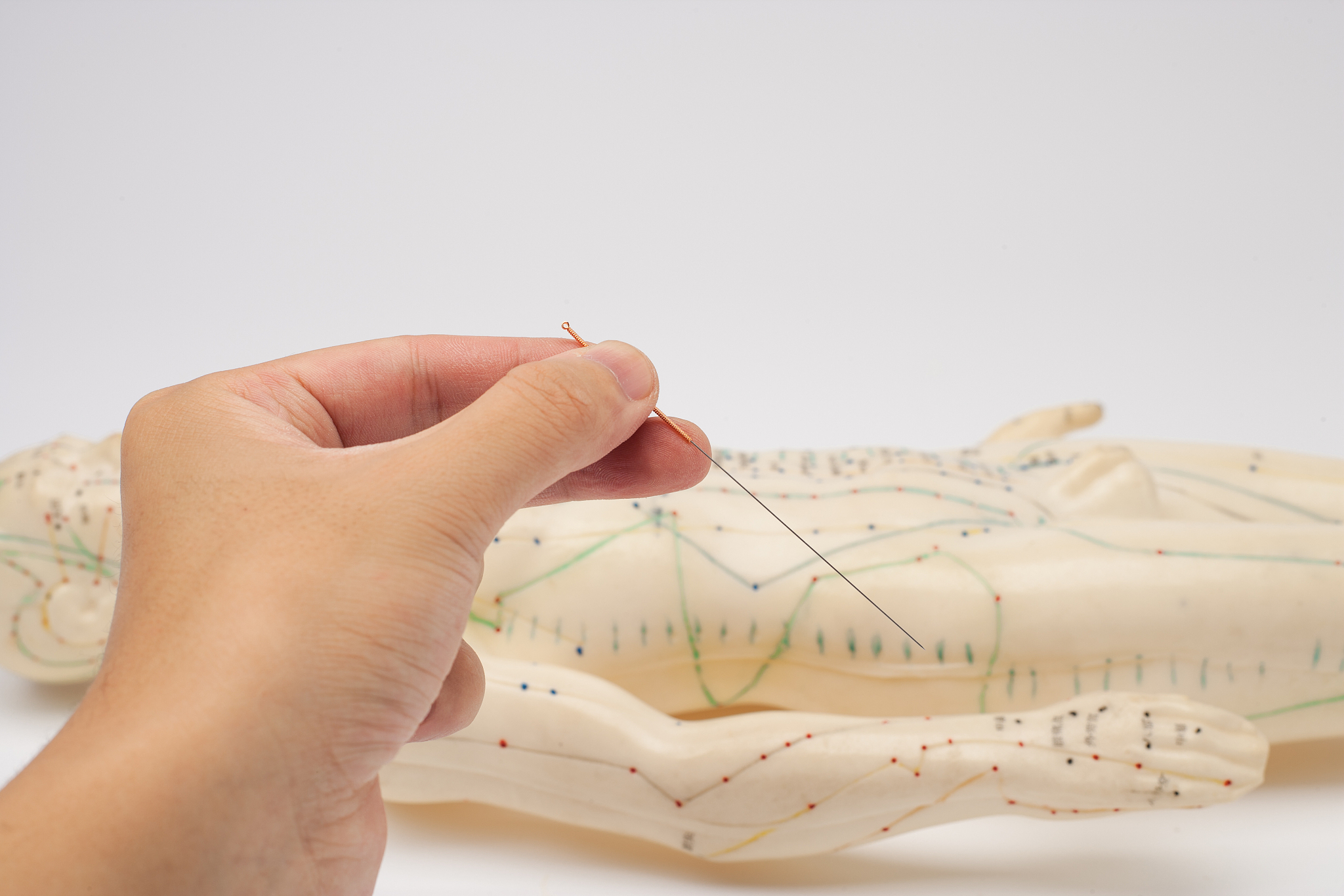 针灸与中医文化：现代背景下的应用与发展