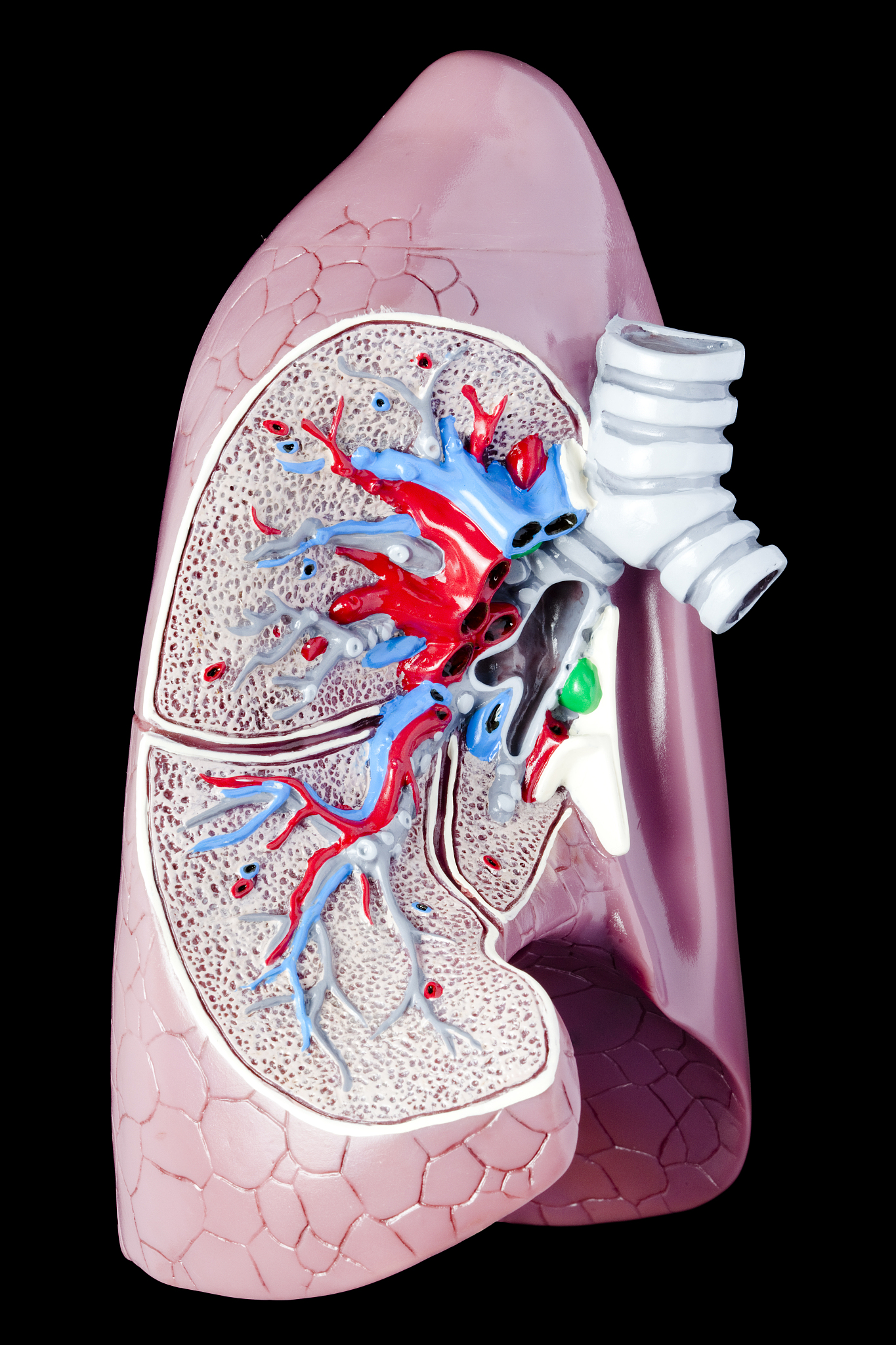 肺部有结节要紧吗？