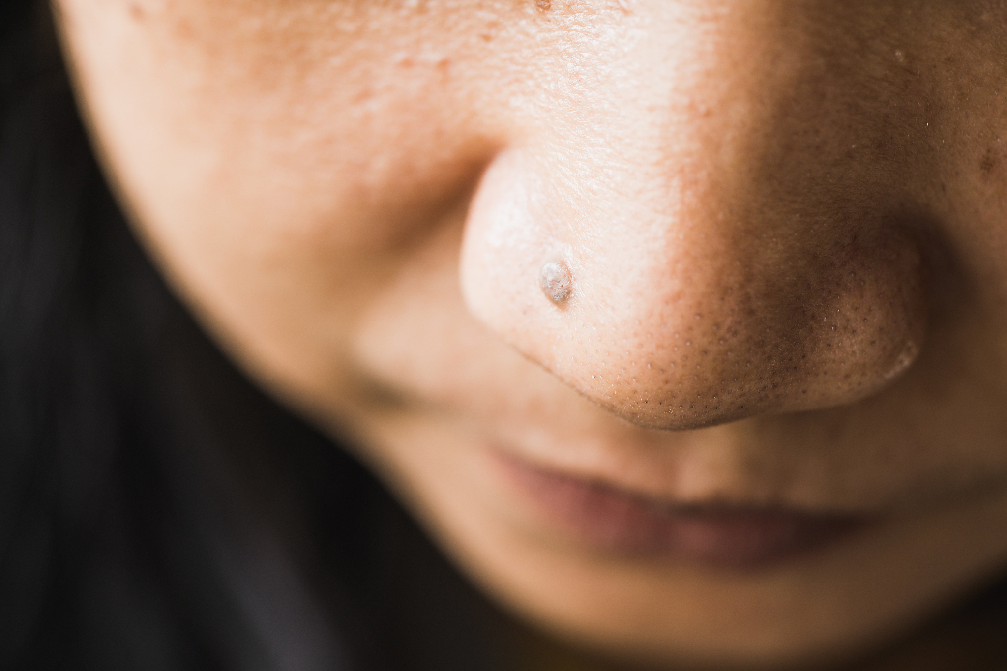 眼下痣代表什么