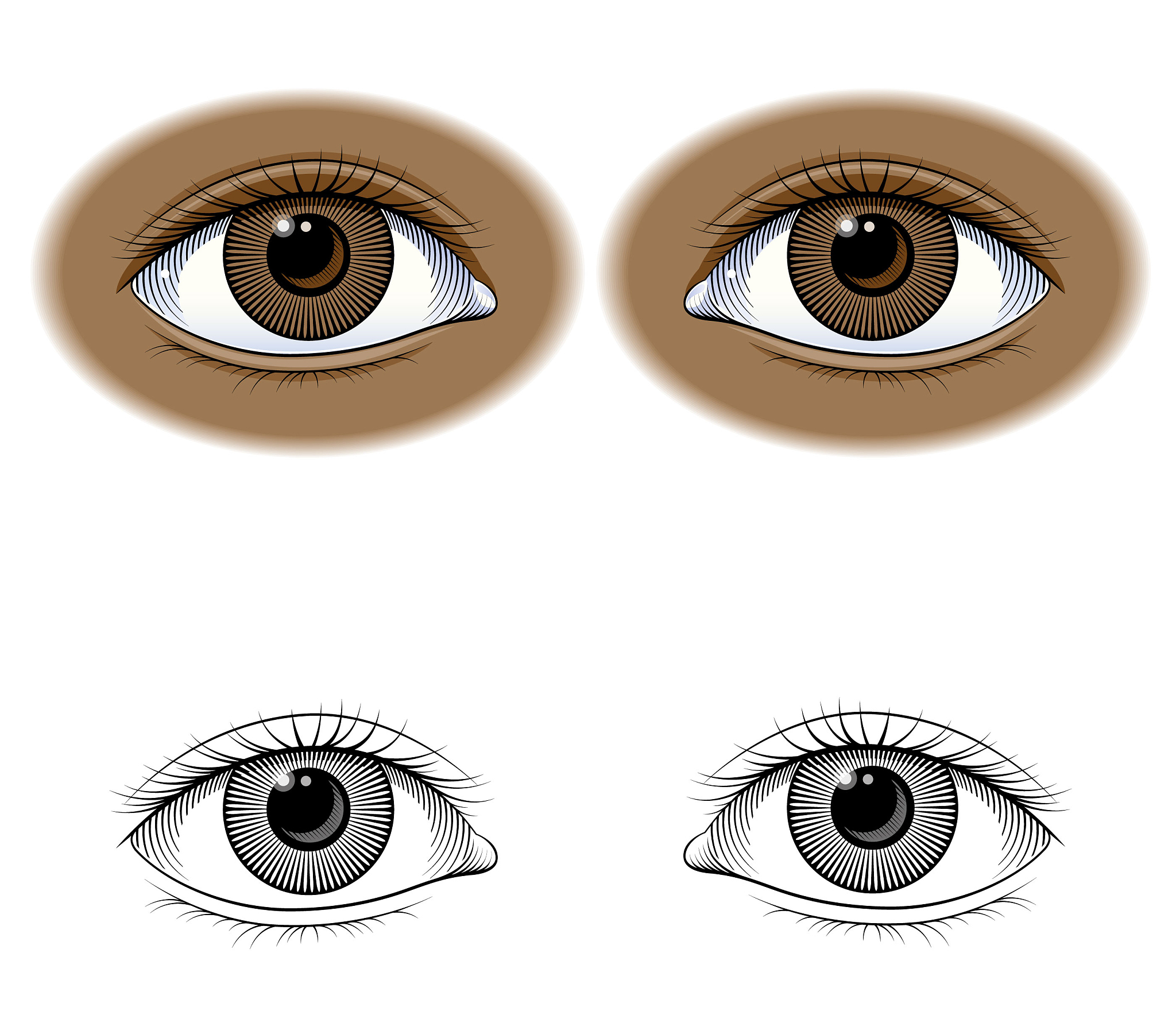 black eye illustration