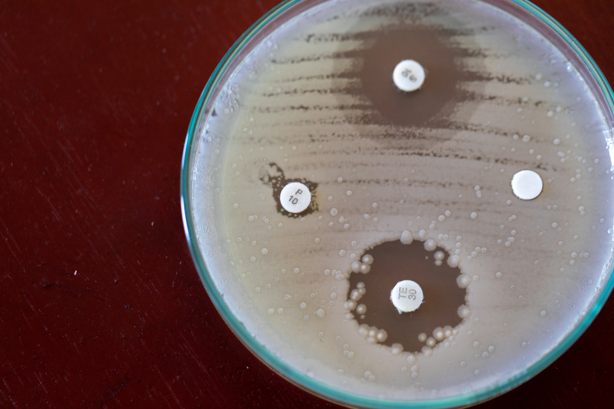 如何培养酵母菌